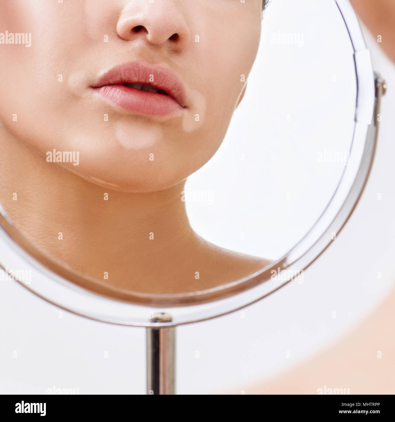 Belle femme avec le vitiligo en regardant dans le miroir. Banque D'Images