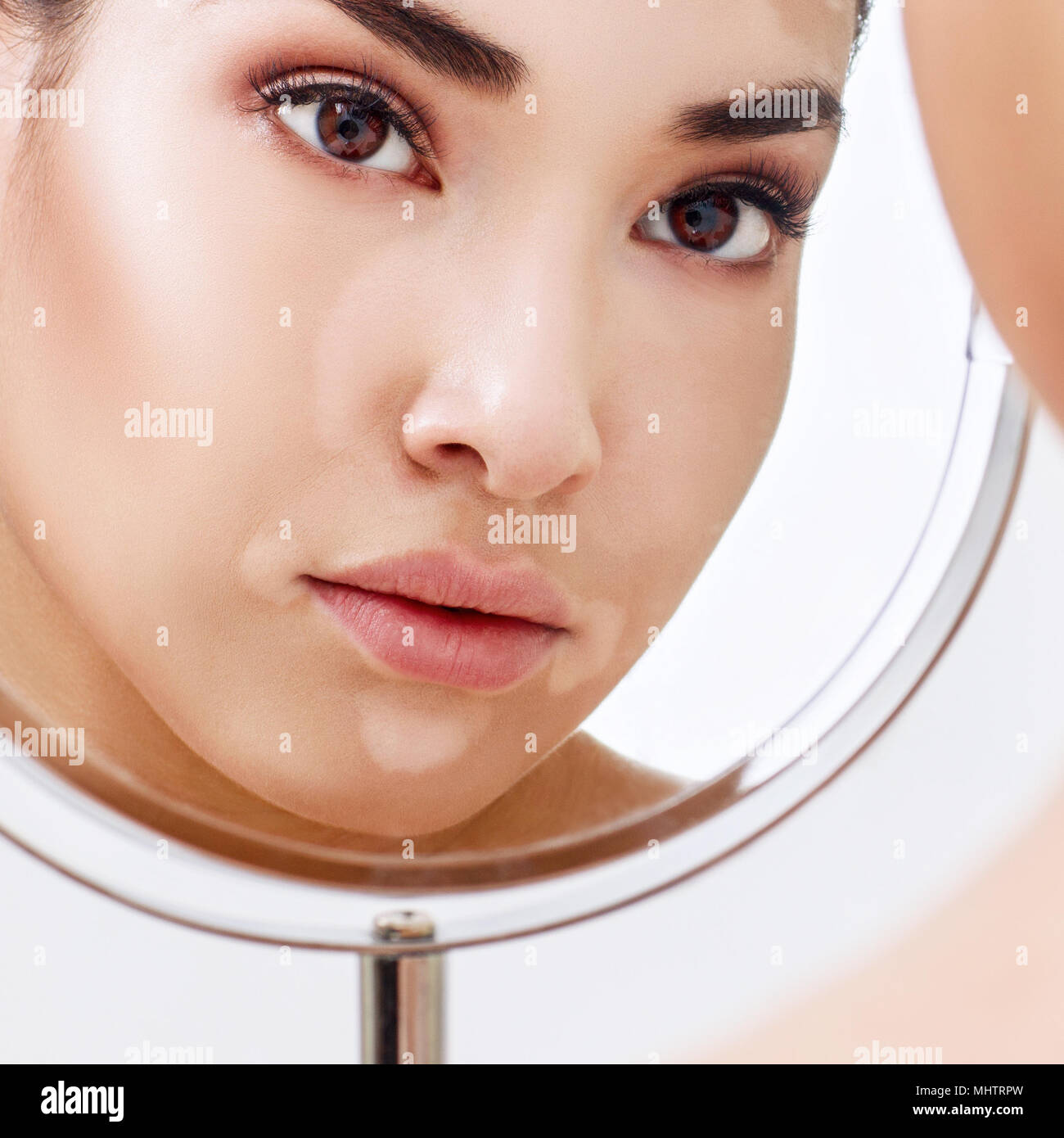 Belle femme avec le vitiligo en regardant dans le miroir. Banque D'Images