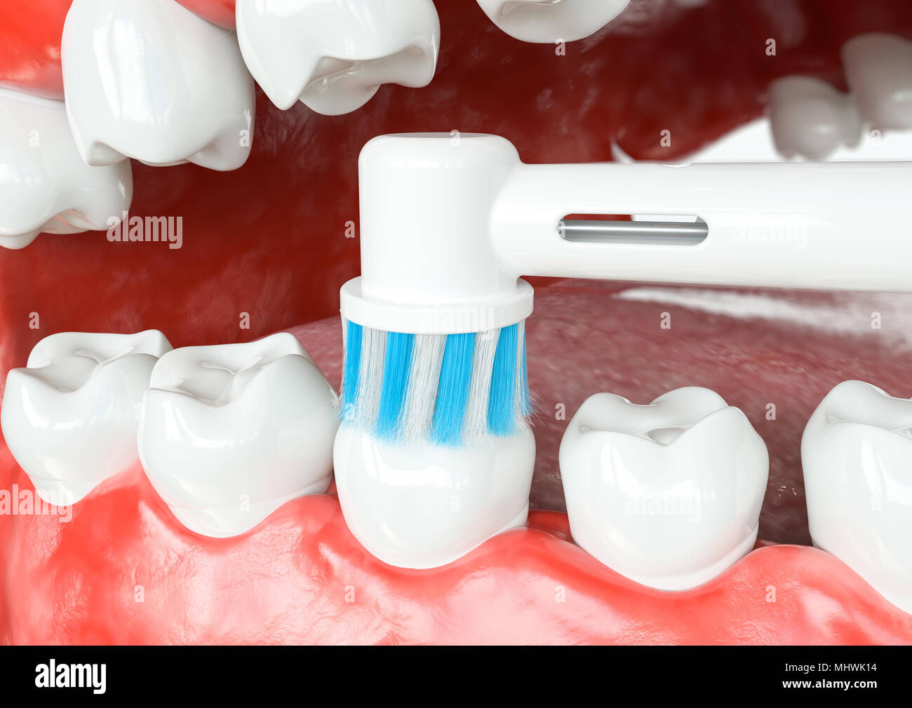 Nettoyage des surfaces occlusales des dents - le rendu 3D Banque D'Images