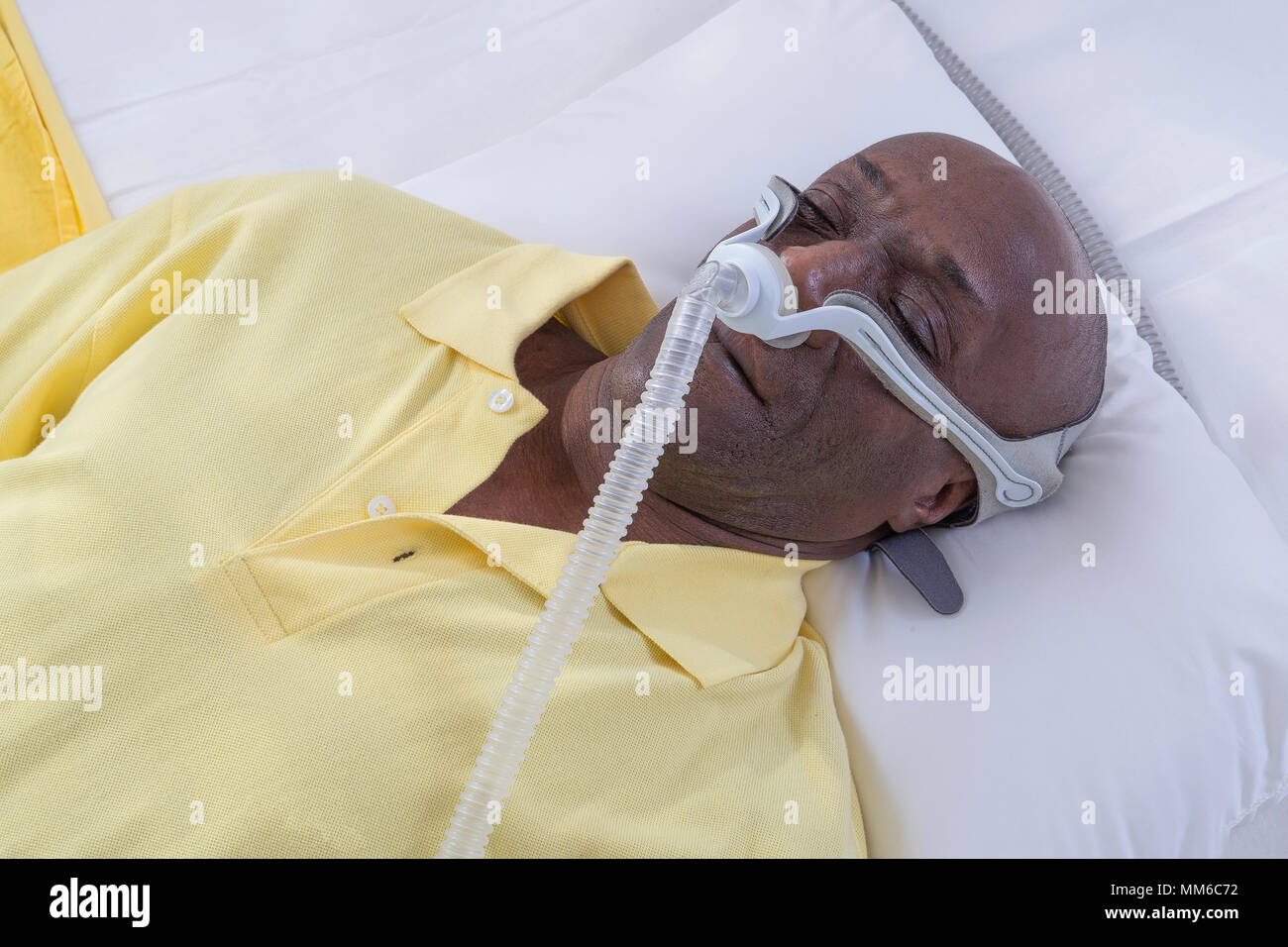 SYNDROME D'APNÉE DU SOMMEIL Banque D'Images