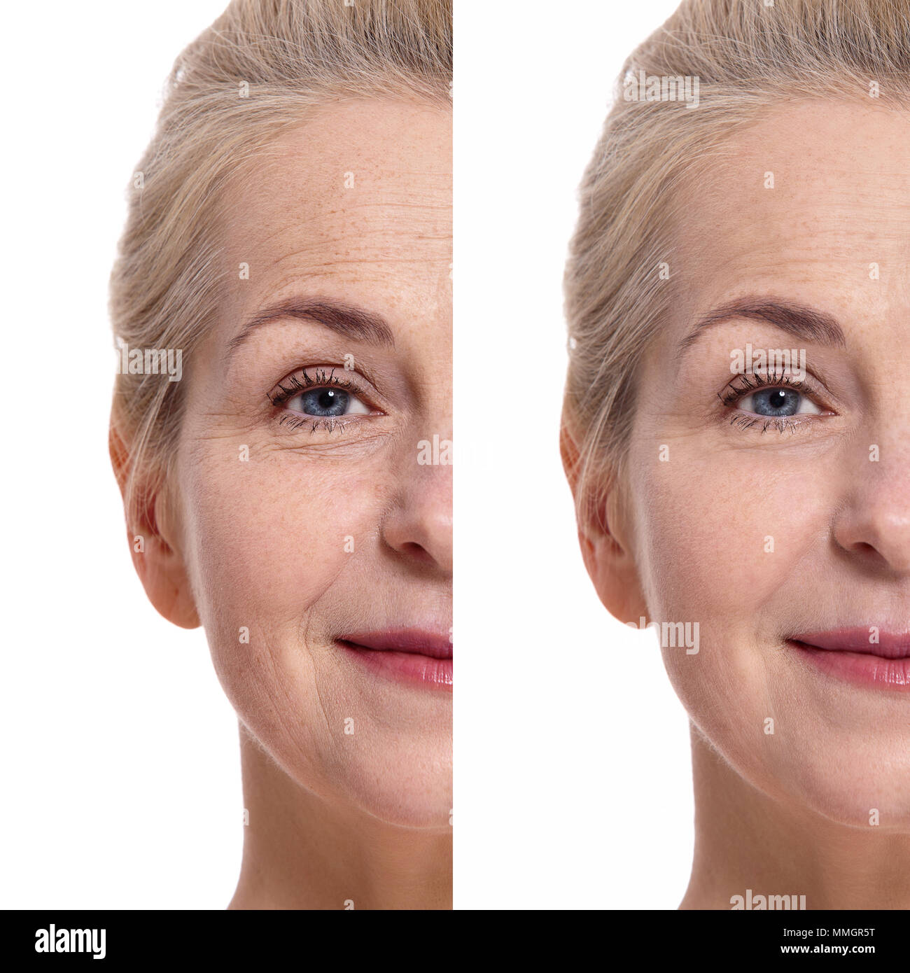 Oman d'âge moyen visage avant et après intervention cosmétique. Concept de chirurgie plastique. Banque D'Images