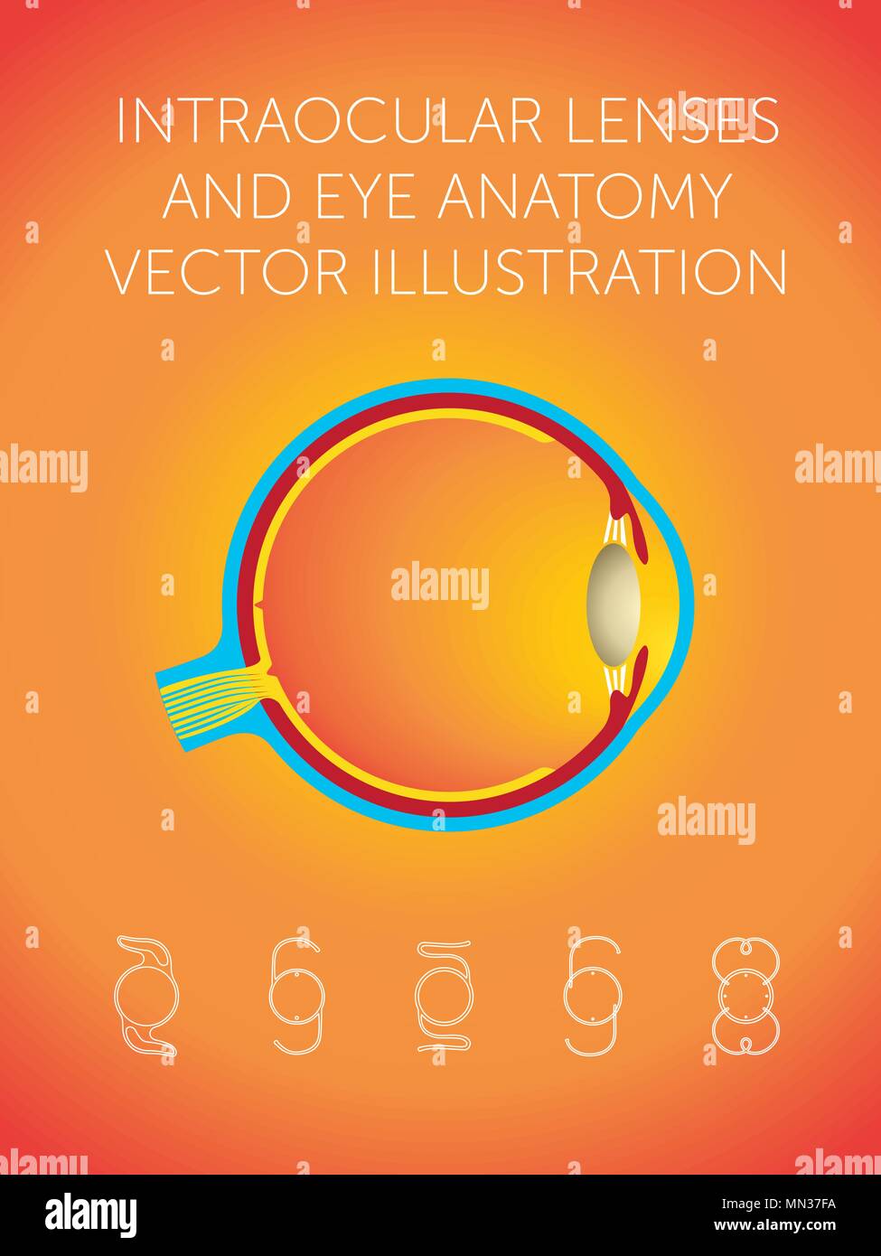 Structure schématique de l'œil et de types de lentilles intraoculaires sur fond orange Illustration de Vecteur