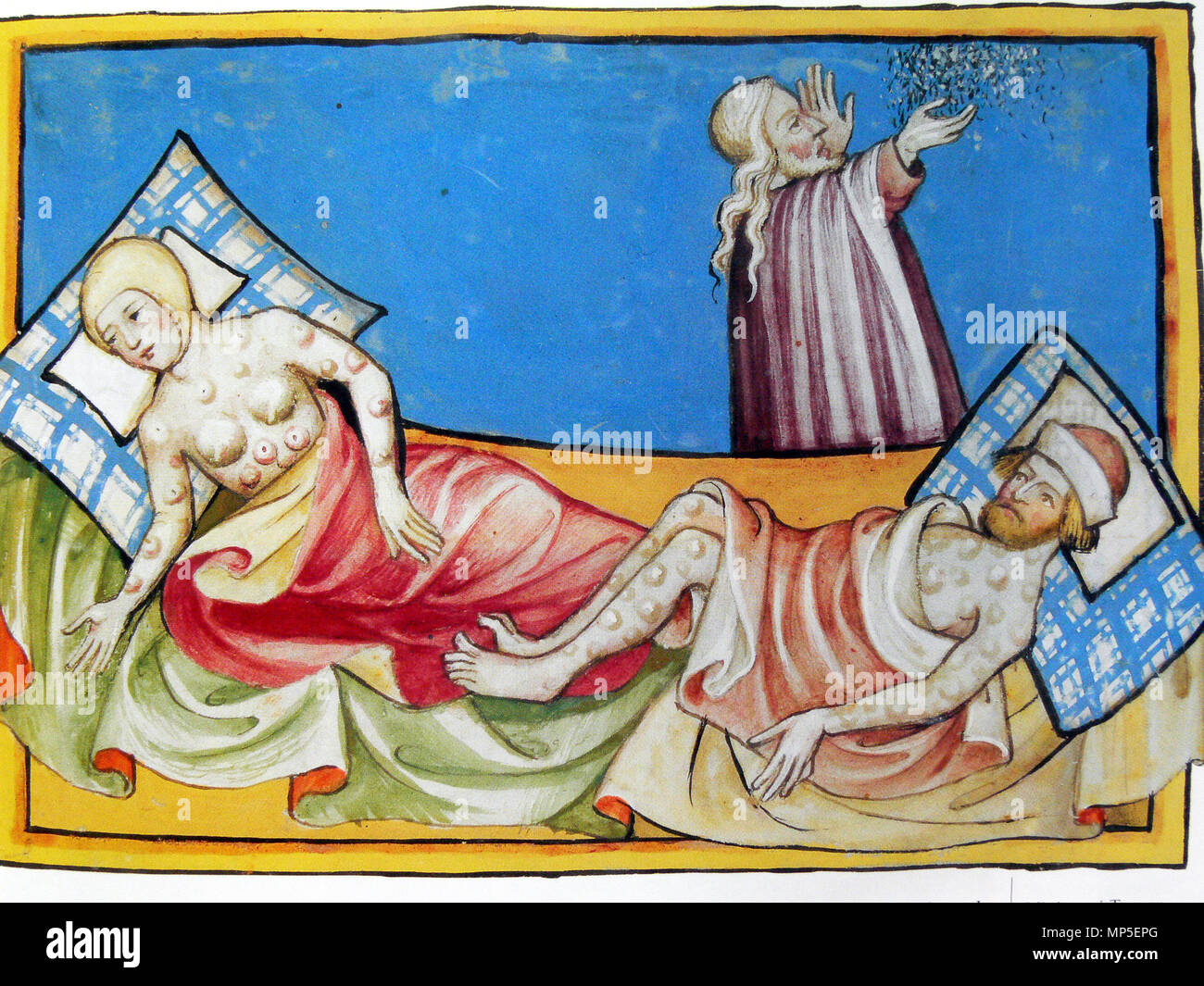 . Deutsch : Toggenburg-Bibel 1994-2000 aus der Schweiz von 1411. ( Die Krankheit wird für allgemein gehalten ravageurs. Die Lage der Beulen oder aber eher Blasen deuten auf Pocken hin.) Anglais : Miniature de la Bible de Toggenburg (Suisse) de 1411. La maladie est largement considéré comme la peste. L'emplacement de bosses ou des vésicules, cependant, est plus compatible avec la variole (comme la peste bubonique normalement les fait uniquement dans l'aine et dans les aisselles), est généralement interprétée comme une représentation de la peste - "La Mort Noire". MS 78 E1 . 1411. La variole 1128 inconnu01 Banque D'Images . Deutsch : Toggenburg-Bibel 1994-2000 aus der Schweiz von 1411. ( Die Krankheit wird für allgemein gehalten ravageurs. Die Lage der Beulen oder aber eher Blasen deuten auf Pocken hin.) Anglais : Miniature de la Bible de Toggenburg (Suisse) de 1411. La maladie est largement considéré comme la peste. L'emplacement de bosses ou des vésicules, cependant, est plus compatible avec la variole (comme la peste bubonique normalement les fait uniquement dans l'aine et dans les aisselles), est généralement interprétée comme une représentation de la peste - "La Mort Noire". MS 78 E1 . 1411. La variole 1128 inconnu01 Banque D'Images