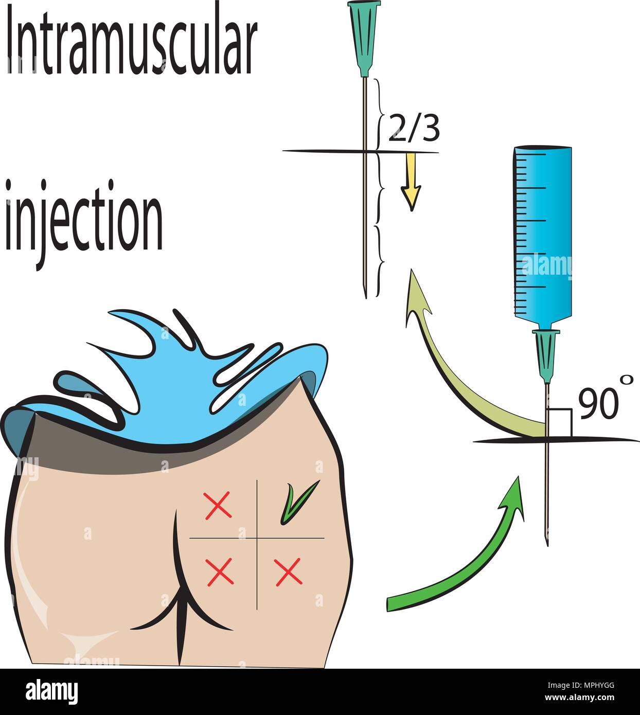 Règles pour l'injection intramusculaire Illustration de Vecteur