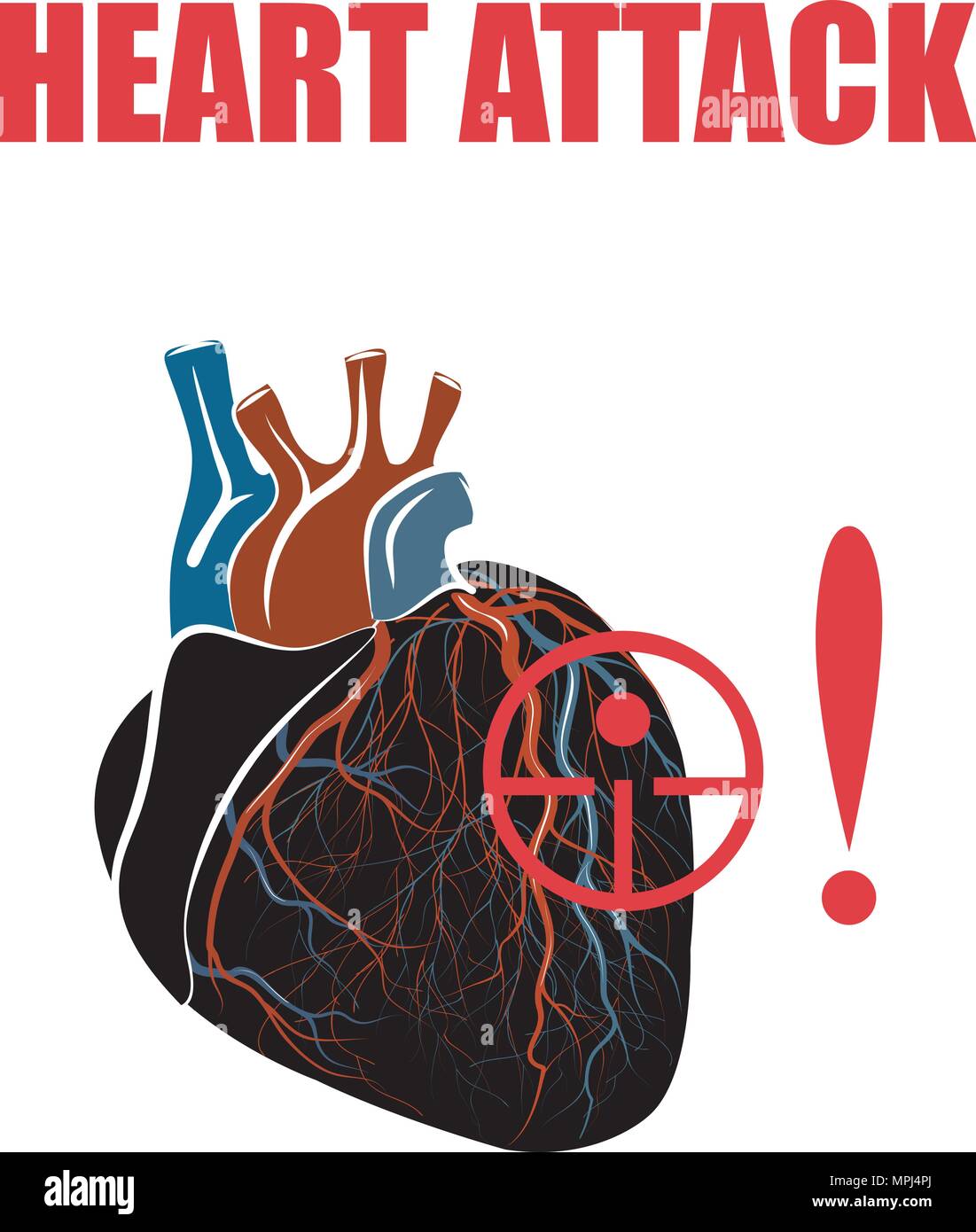 Coeur. Infarctus du myocarde. illustration d'un coeur humain, les crises cardiaques Illustration de Vecteur