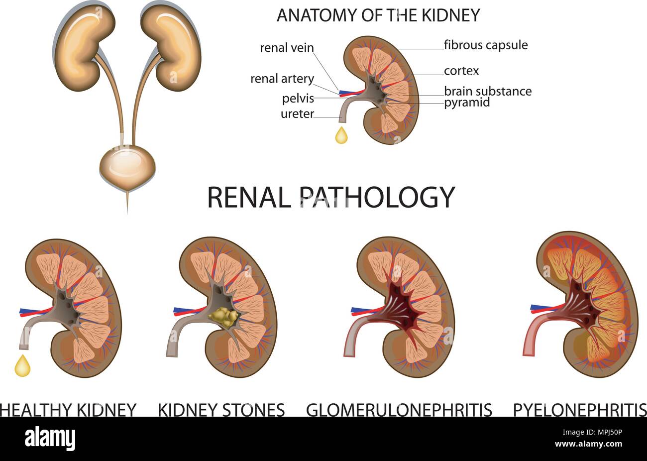 La pathologie des reins les reins de l'anatomie. Illustration de Vecteur La pathologie des reins les reins de l'anatomie. Illustration de Vecteur