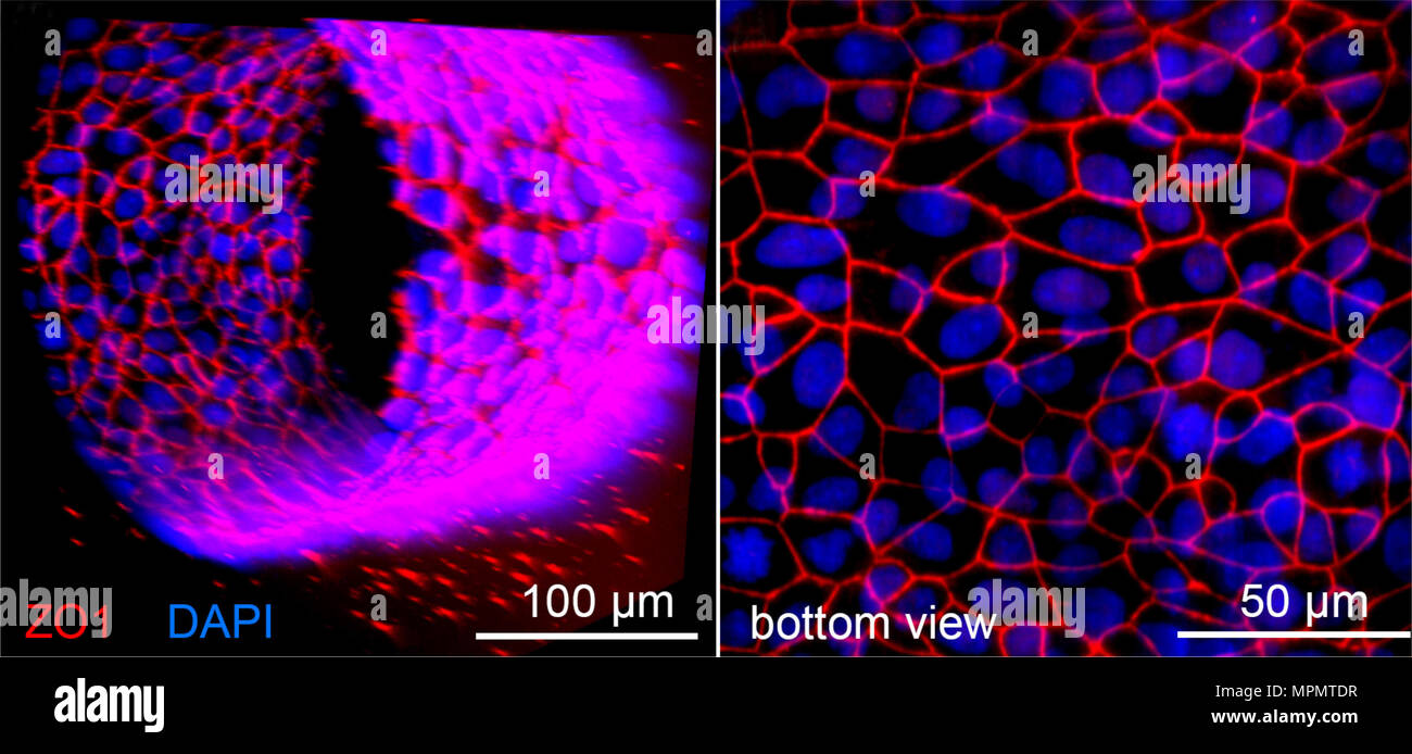 Image d'un microscope confocal origine tissulaire des microvaisseaux formés à partir de cellules endothéliales microvasculaires du cerveau humain dans une matrice 3D. Image courtoisie du Professeur Peter Searson, Johns Hopkins University. Banque D'Images