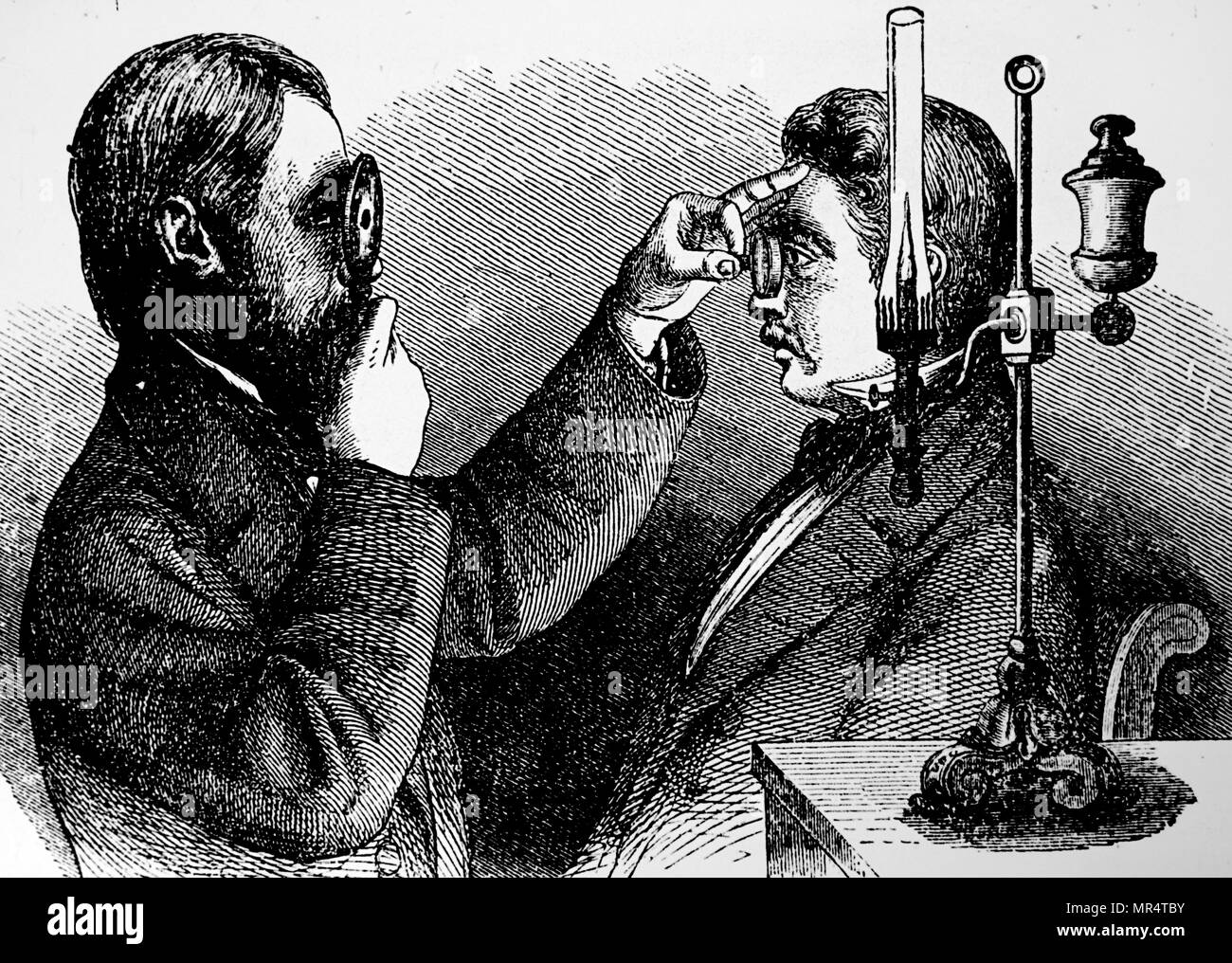 Gravure représentant un ophthalmoscope en usage. L'ophtalmoscopie, également appelé examen, est un test qui permet à un professionnel de la santé de voir l'intérieur du fond d'oeil et d'autres structures. L'ophthalmoscope a été inventée par Hermann von Helmholtz (1821-1894) un médecin et physicien allemand. En date du 19e siècle Banque D'Images