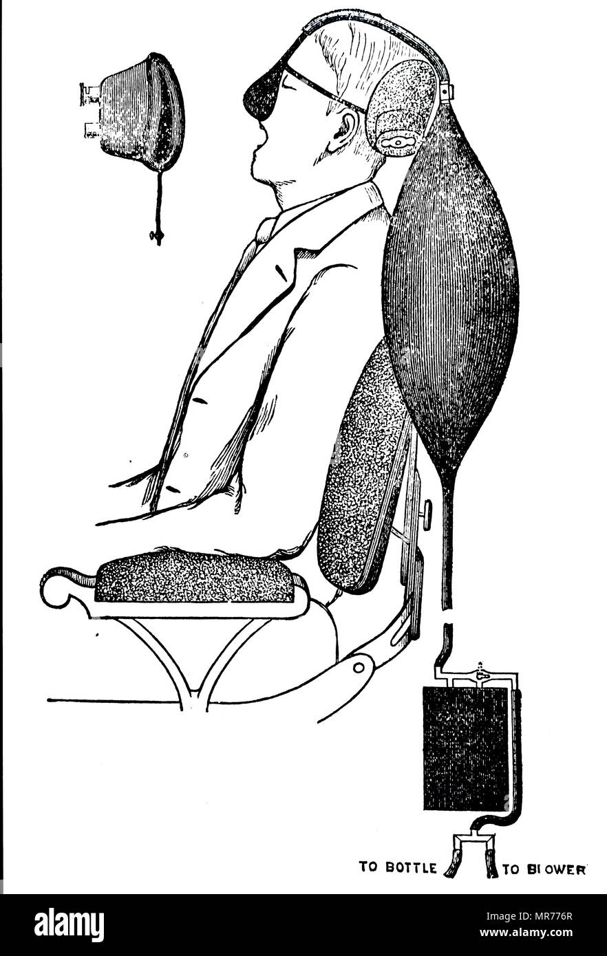 Illustration de l'appareil de Coleman pour administrer une anesthésie prolongée par l'oxyde nitreux (gaz hilarant). En date du 20e siècle Banque D'Images