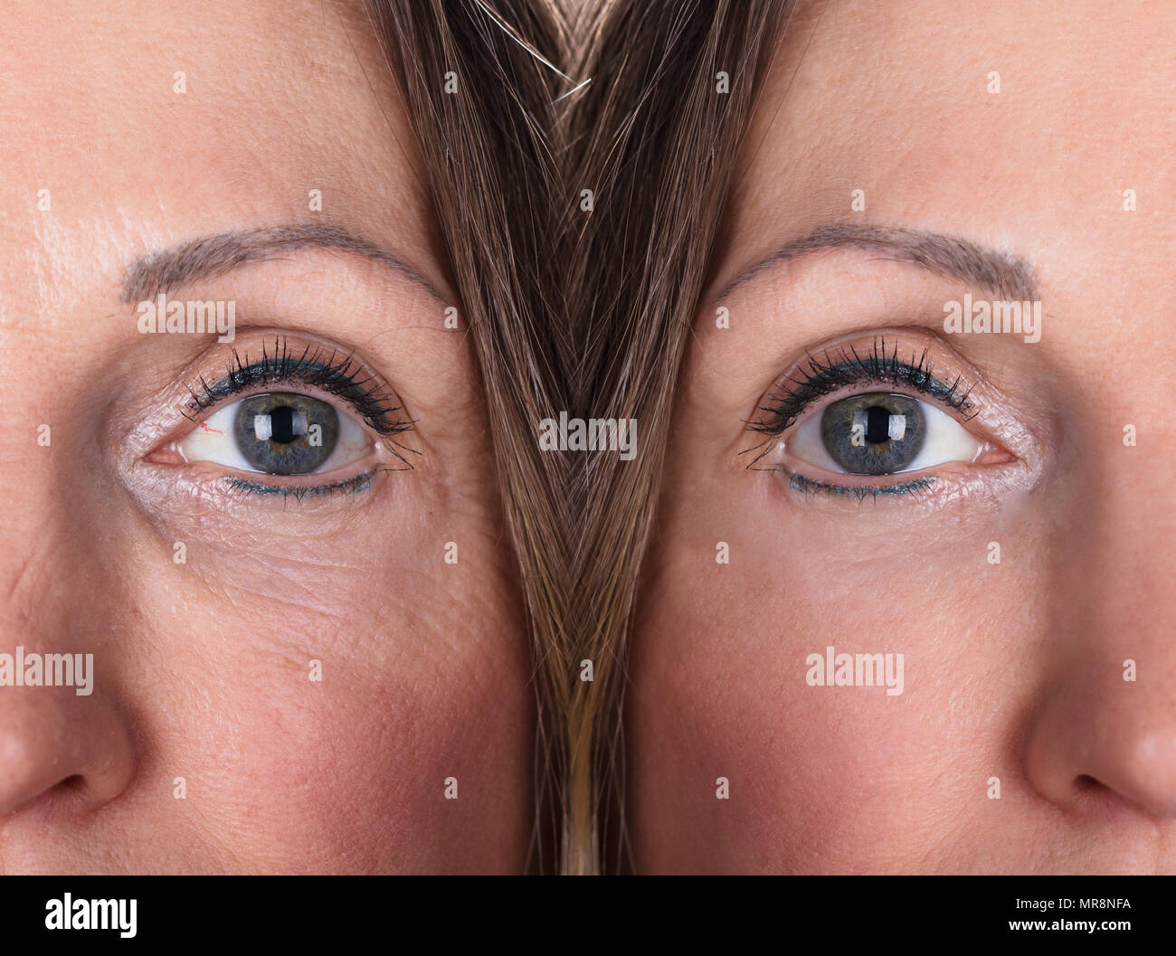 Photo de procédures anti-vieillissement sur Caucasian Woman Face Banque D'Images