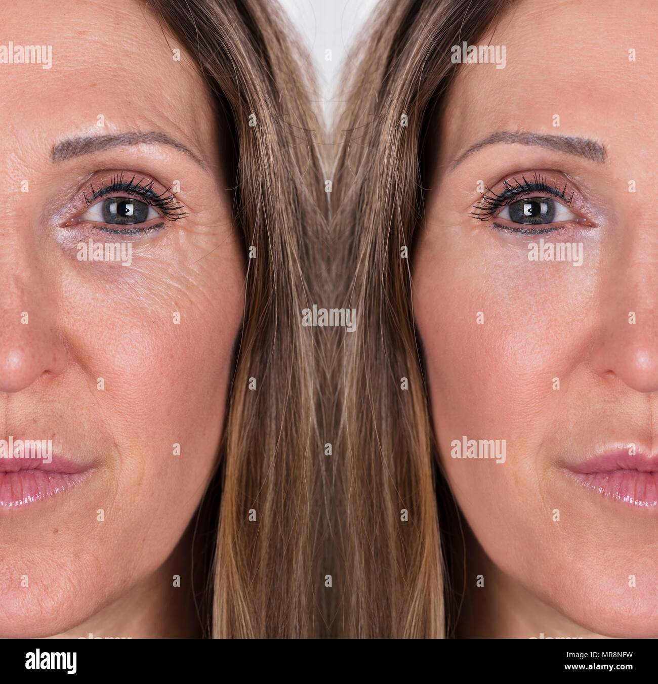 Photo de procédures anti-vieillissement sur Caucasian Woman Face Banque D'Images