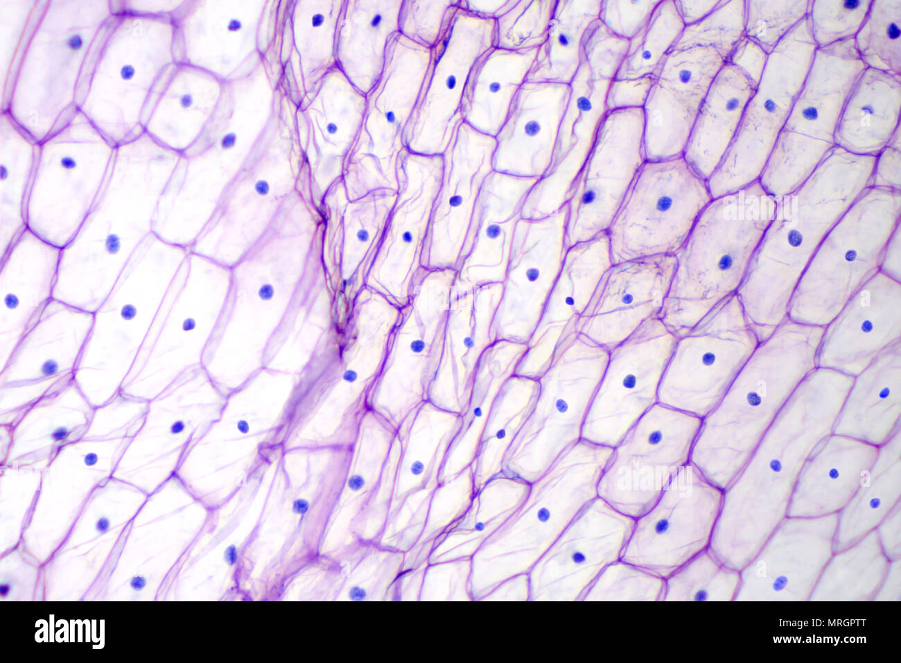 L Epiderme D Oignon Sous Microscope Optique De Couleur Pourpre De Grandes Cellules Epidermiques D Un Oignon Allium Cepa En Une Seule Couche Photo Photo Stock Alamy L Epiderme D Oignon Sous Microscope Optique De Couleur Pourpre De Grandes Cellules Epidermiques D Un Oignon Allium Cepa En Une Seule Couche Photo Photo Stock Alamy