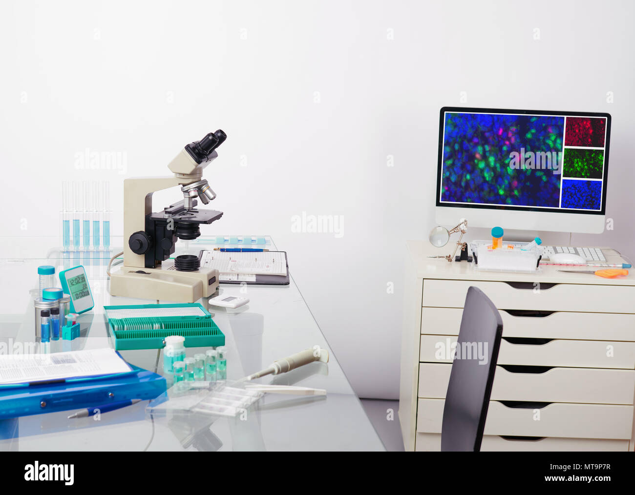 Station de travail microscopique. Microscope, le moniteur de l'ordinateur avec digital image fluorescente et d'outils pour la coloration histologique de tissu pour la détection du cancer une Banque D'Images