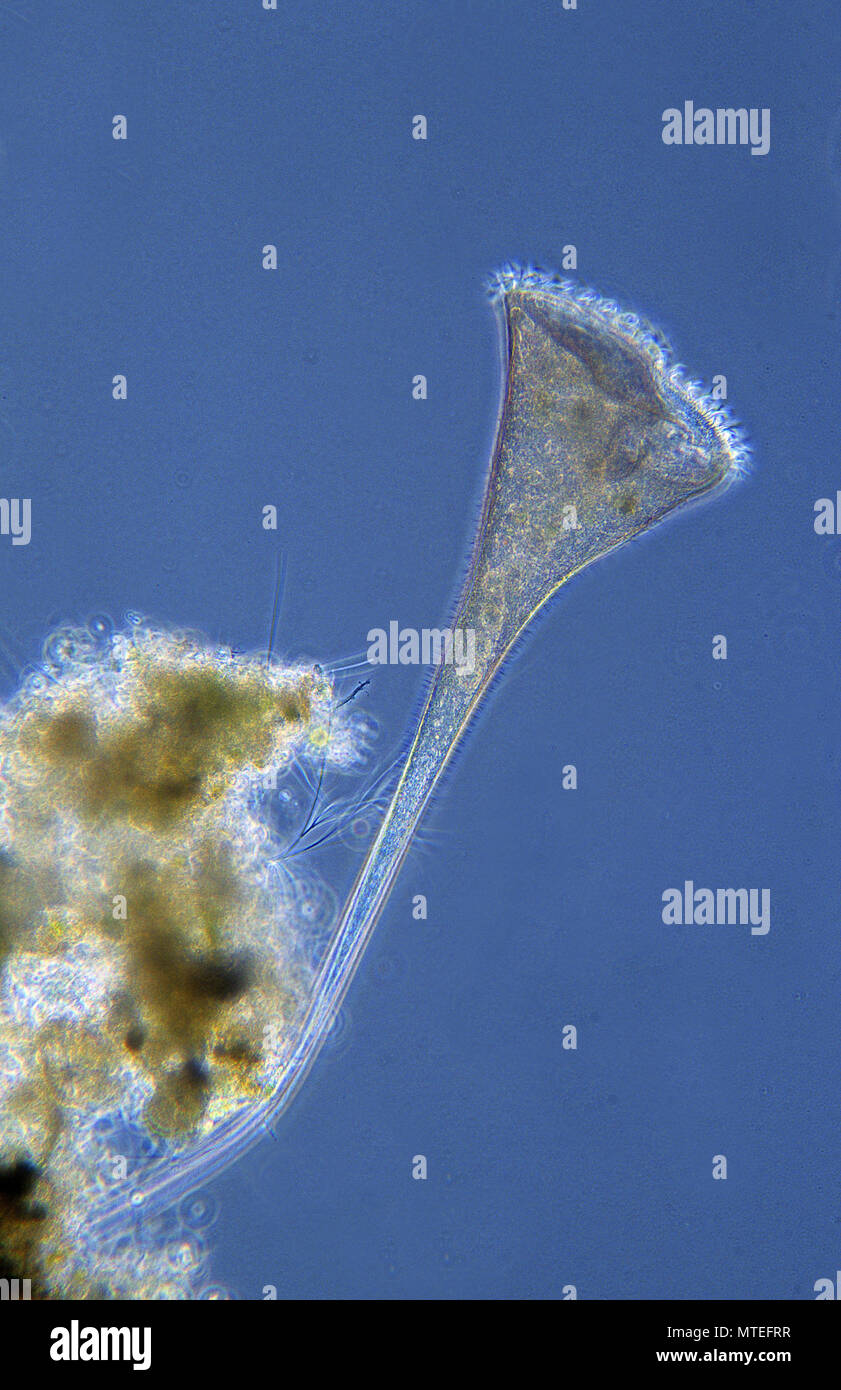 Protozoaires Stentor.Ciliata.microscopie optique. Banque D'Images