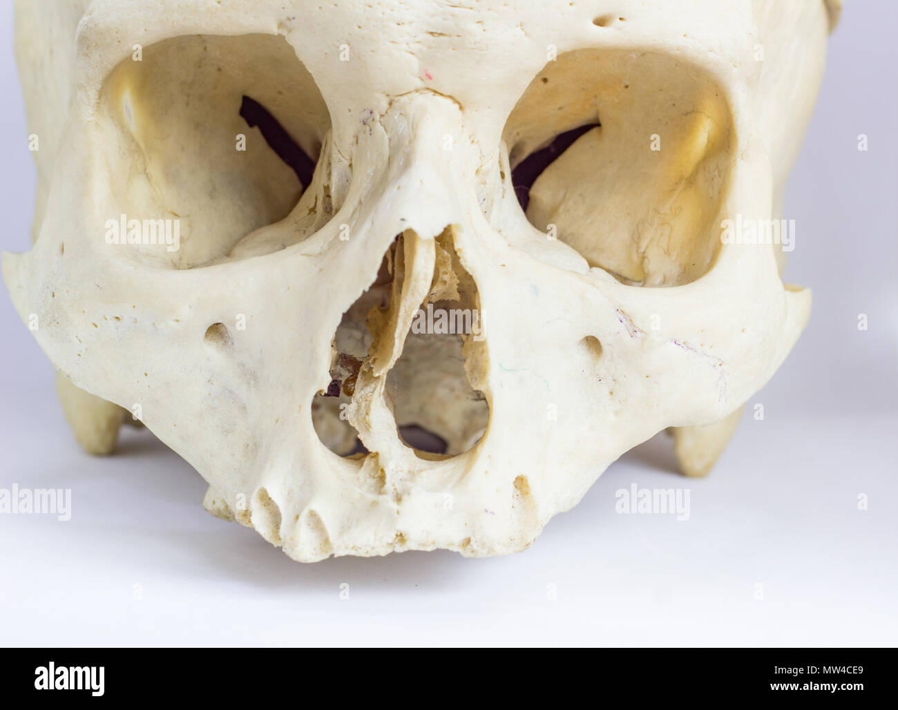 Close up macro-vision des droits de l'os du crâne montrant l'anatomie de foramen nasale, la cloison nasale et cavité orbitaire Banque D'Images