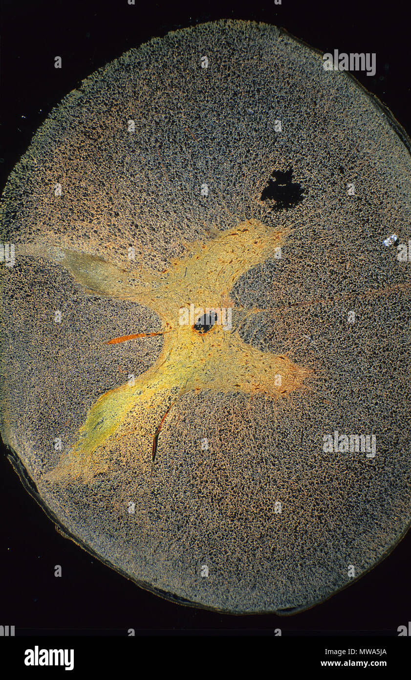 Neurone multipolaire de la moelle épinière.les tissus nerveux.7x Banque D'Images