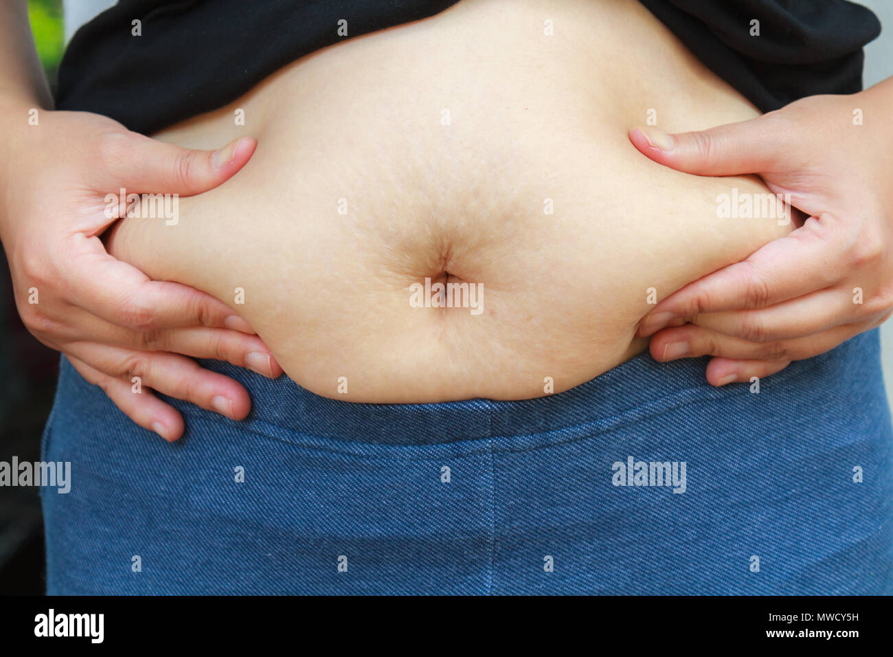 Asian girl paunchy surpoids fat devrait perdre du poids. Banque D'Images