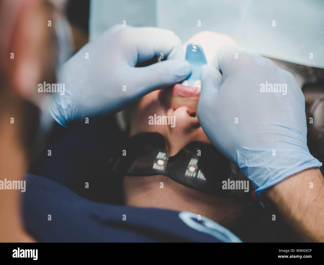 Un médecin travaillant avec machine CNC fraisage dentaire. Spesialist préparer les dents du patient pour les placages en céramique avec des outils spéciaux. Esthétique dentaire, médecine, stomatologie concept. Banque D'Images