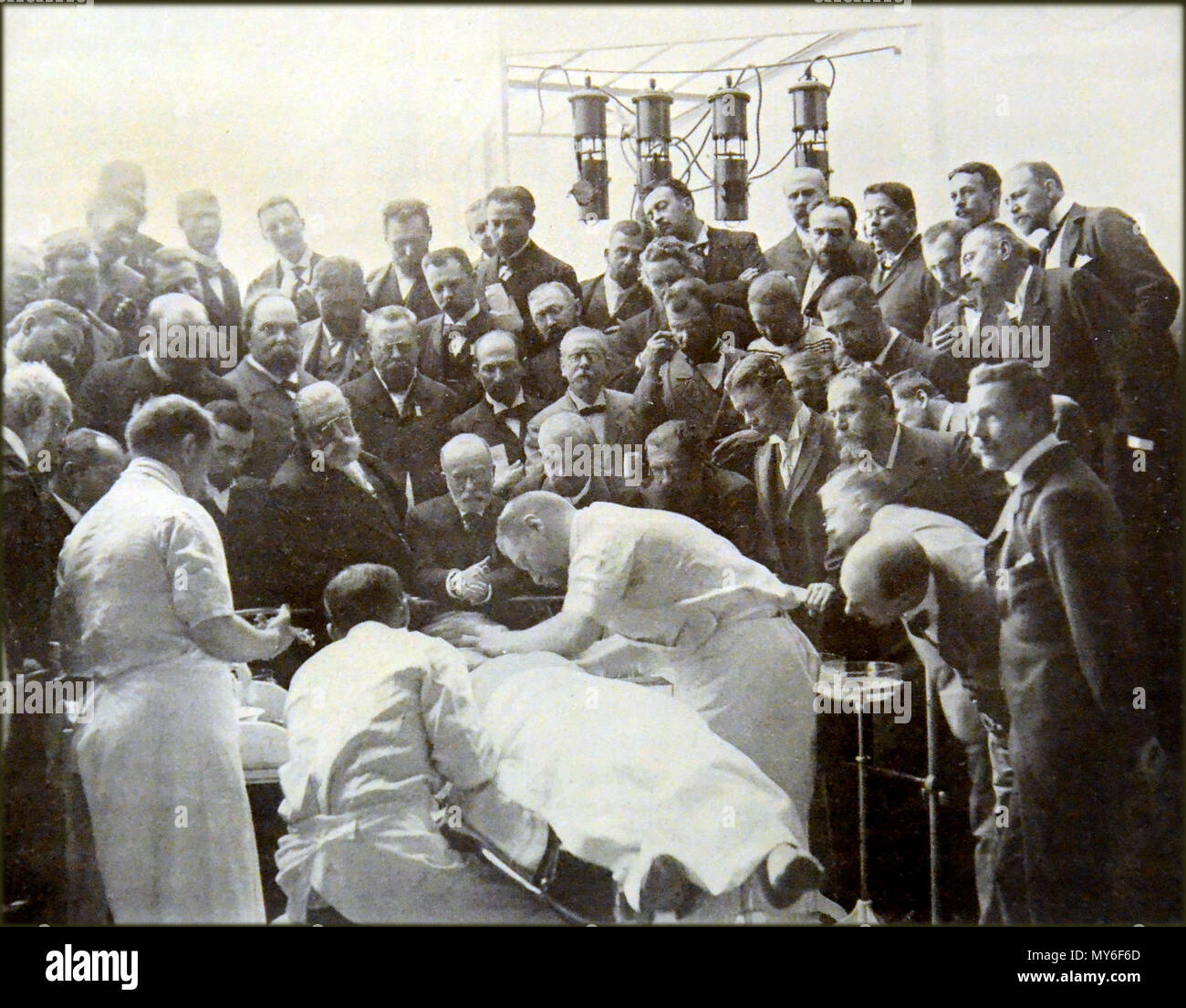 399 OpérationCraniectomieAout1900 Banque D'Images