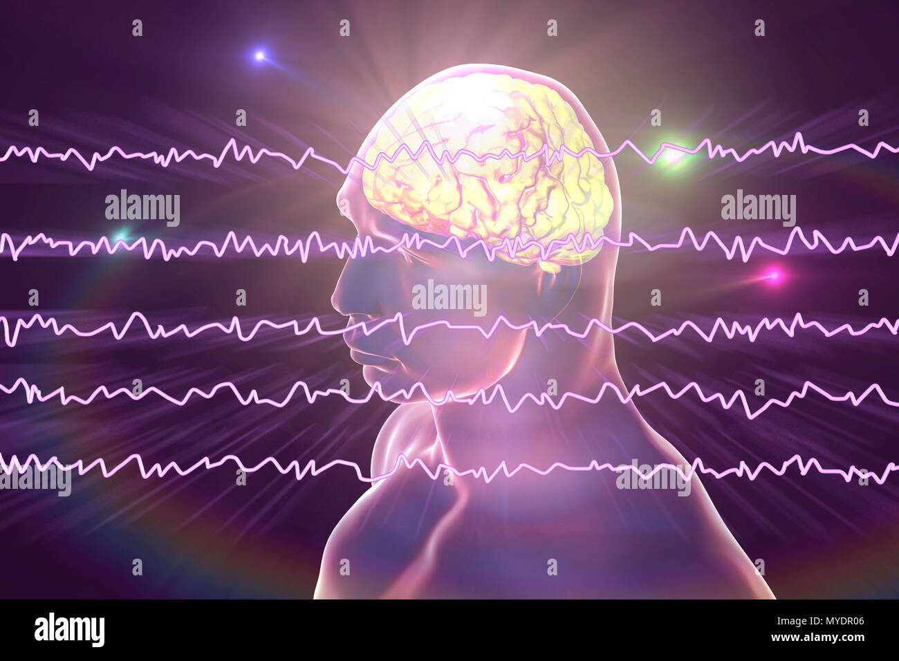 Cerveau et active les ondes cérébrales, illustration de l'ordinateur. Un électroencéphalogramme (EEG) mesure l'activité électrique dans le cerveau à l'aide d'électrodes fixées sur le cuir chevelu. Divers troubles peuvent être diagnostiquées par l'analyse des résultats de l'EEG. Banque D'Images