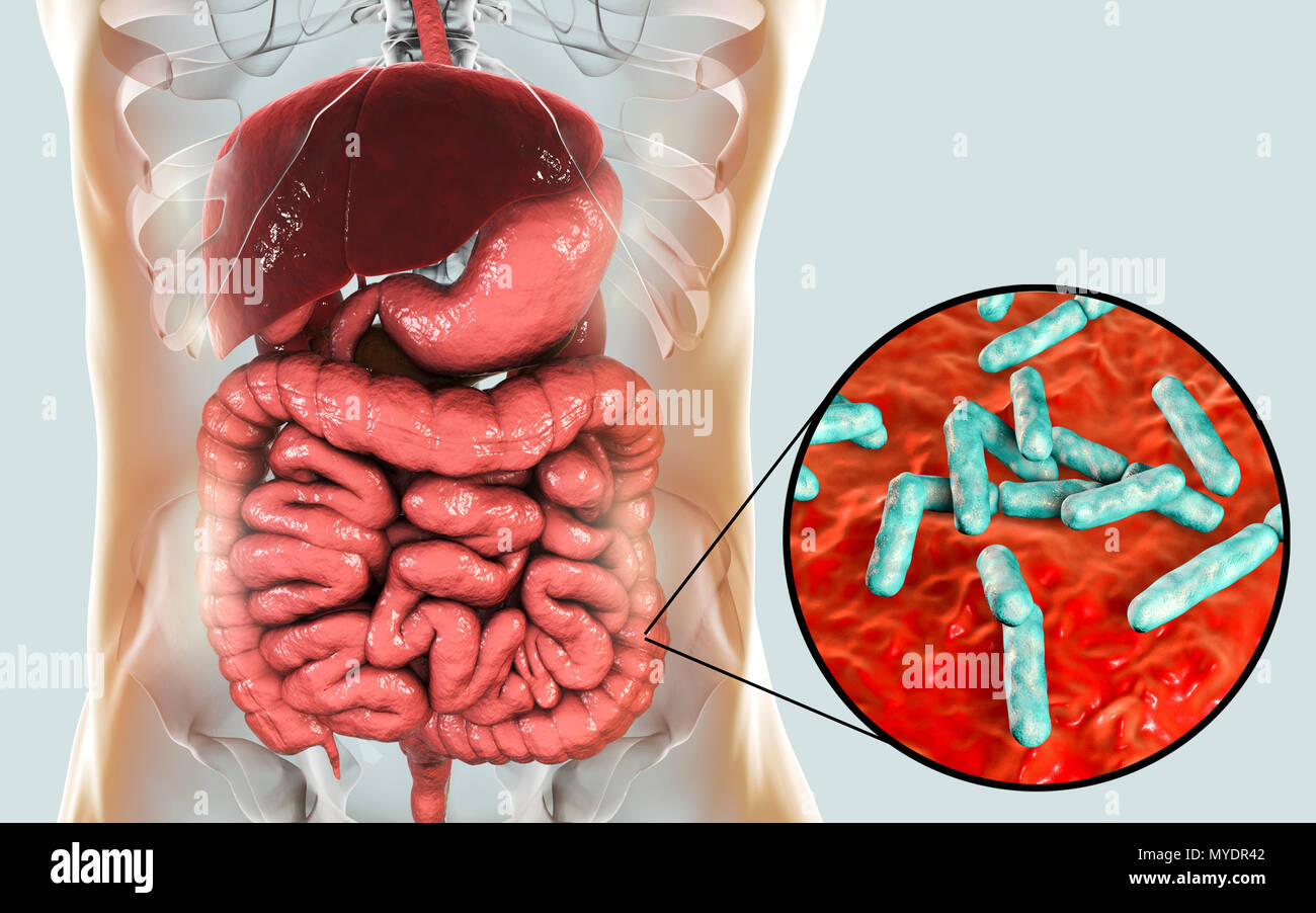 Illustration de Bifidobacterium bactéries dans l'intestin humain. Cette bactéries anaérobies à Gram positif est l'élément principal du gros intestin humain microbiome. Il a un métabolisme de l'hexose (sucre), appelé le shunt bifide, qui peut être utilisé comme test de diagnostic pour les bifidobactéries. Les bifidobactéries sont les bactéries probiotiques, ce qui signifie qu'ils peuvent avoir une incidence sur la propriété véritable hôte sur l'ingestion par l'amélioration de l'équilibre de la microflore intestinale. Banque D'Images