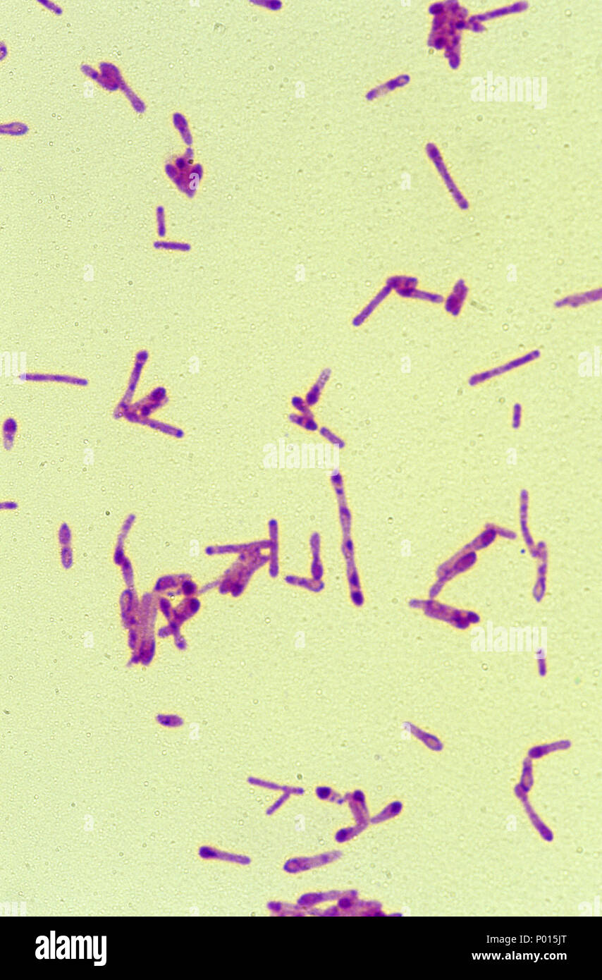La bactérie Clostridium botulinum Banque D'Images