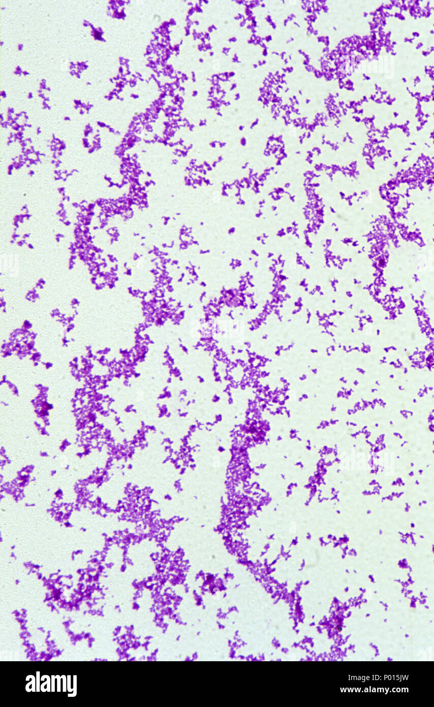 La bactérie Corynebacterium diphtheriae Banque D'Images