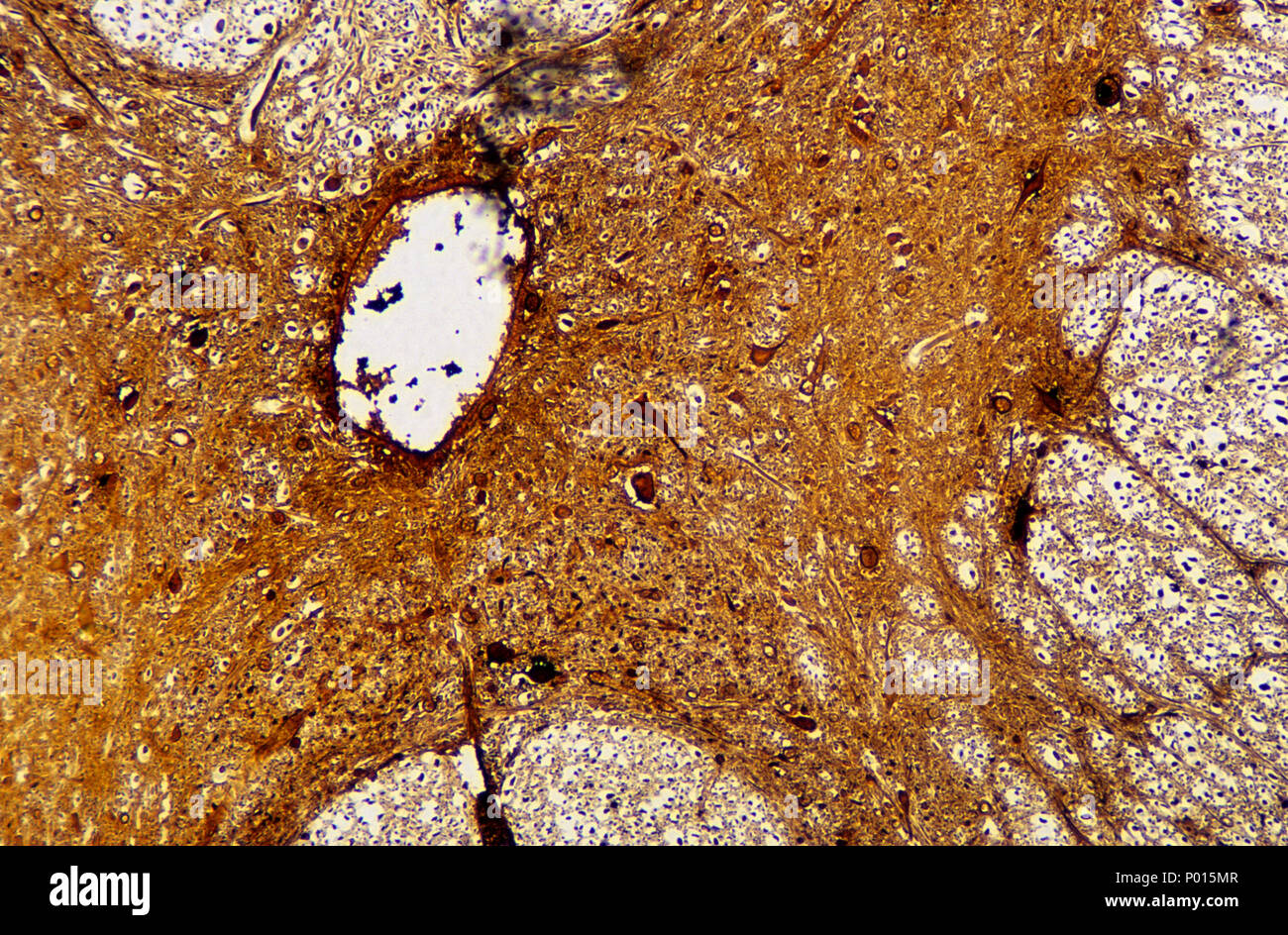 Neurone multipolaire de la moelle épinière. Les tissus nerveux Banque D'Images