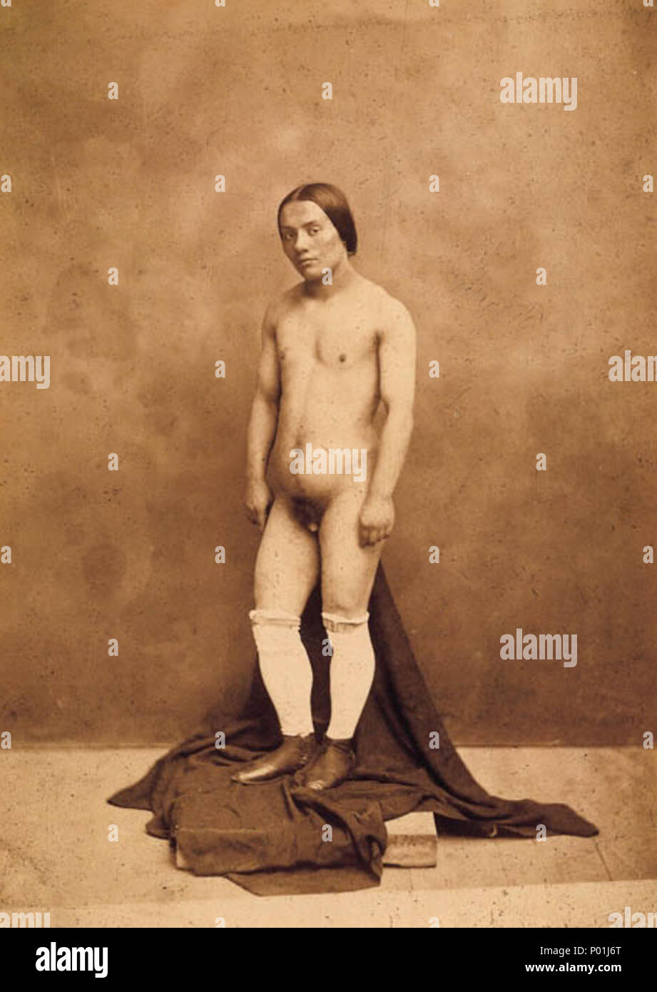 . Photographie d'un hermaphrodite montrant les parties génitales . L'hermaphrodisme . 186011 1 hermaphrodites par Nadar Banque D'Images