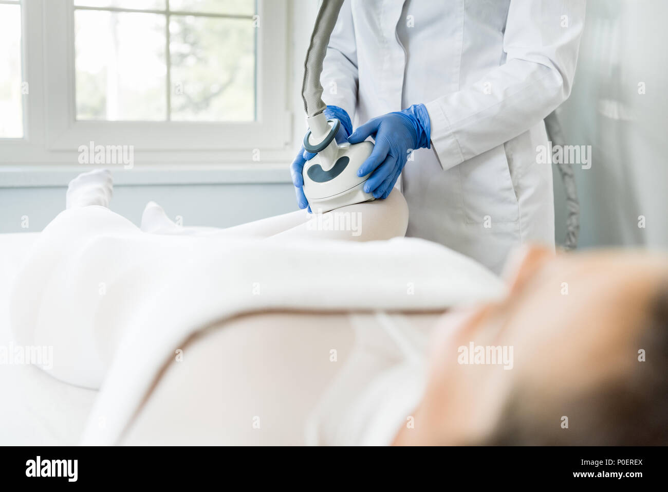 Jeune femme ayant intérieur de lipomassage sur jambes en clinique cosmétologie appareil Banque D'Images