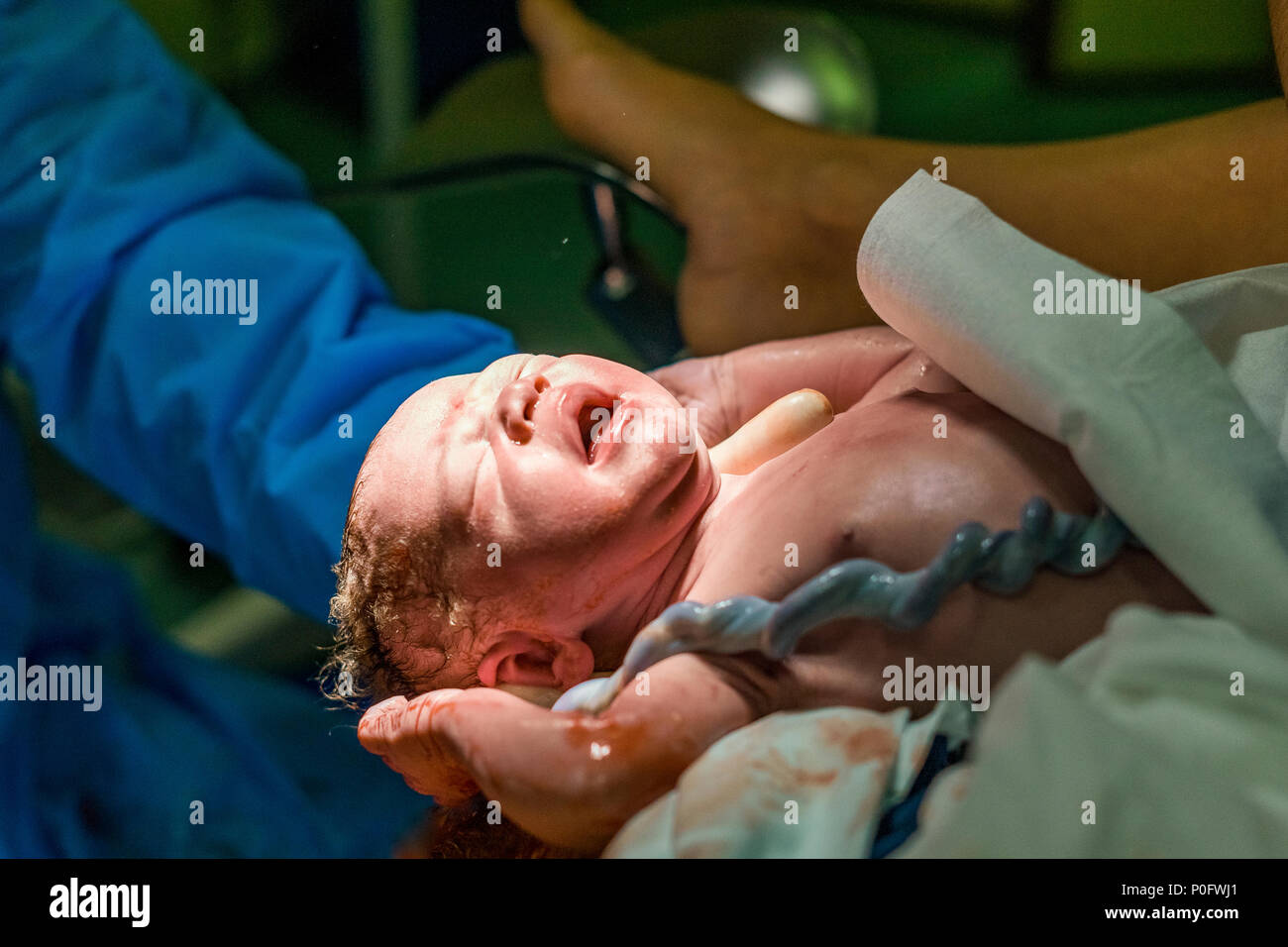 Cordon De Naissance Banque D Image Et Photos Alamy Cordon De Naissance Banque D Image Et Photos Alamy