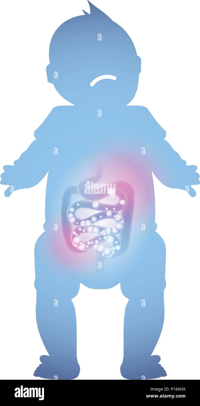 Abstract Illustration D Un Bebe Malade De L Intestin La Digestion D Un Enfant Malade Image Vectorielle Stock Alamy