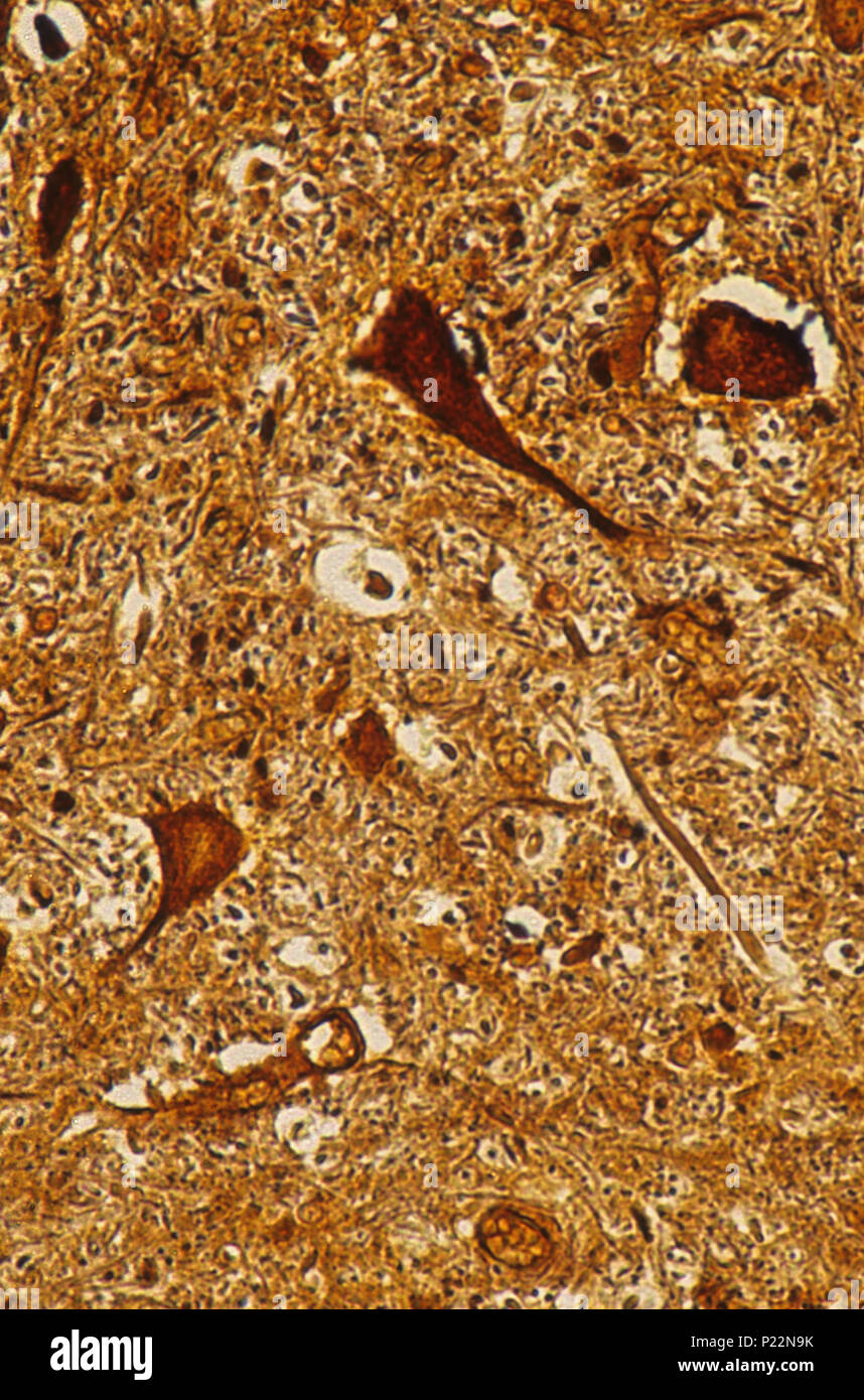 Neurone multipolaire du cordon médullaire. Les tissus nerveux 140x Banque D'Images
