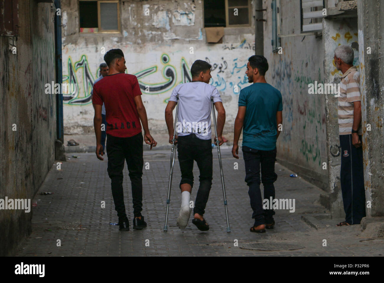 16 juin 2018 - hmed Jawad Mahmoud Othman a été tourné à sa gauche avec une balle de la vie par un tireur israélien le 14 mai lors de manifestations sur l'Gaza-Israeli frontière, à l'Est de l'al-Burej, camp de réfugiés contre le Président'Atout reconnaissance de Jérusalem comme capitale d'Israël et le transfert de l'ambassade des Etats-Unis de Tel Aviv à Jérusalem. 19 ans Ahmed Jawad vit dans l'Al- camp de réfugiés palestiniens de Bureij, dans le centre de la bande de Gaza. Le camp est très peuplée avec 34 951 habitants, 28 770 d'entre eux sont des réfugiés, et il n'a pas de système d'égout. La bande de Gaza hos Banque D'Images