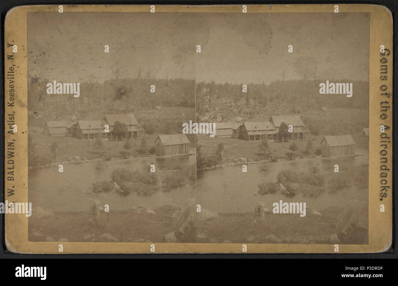 . Bartlett's Hotel. Titre alternatif : les gemmes des Adirondacks. Création : ca. 1870. Référence : [ca. 1870]. Mentions légales Source : 1860 ?-1885 ?. Point numérique publié le 2-16-2006 ; mise à jour 2-11-2009. 29 Bartlett's Hotel, par G. W. Baldwin Banque D'Images