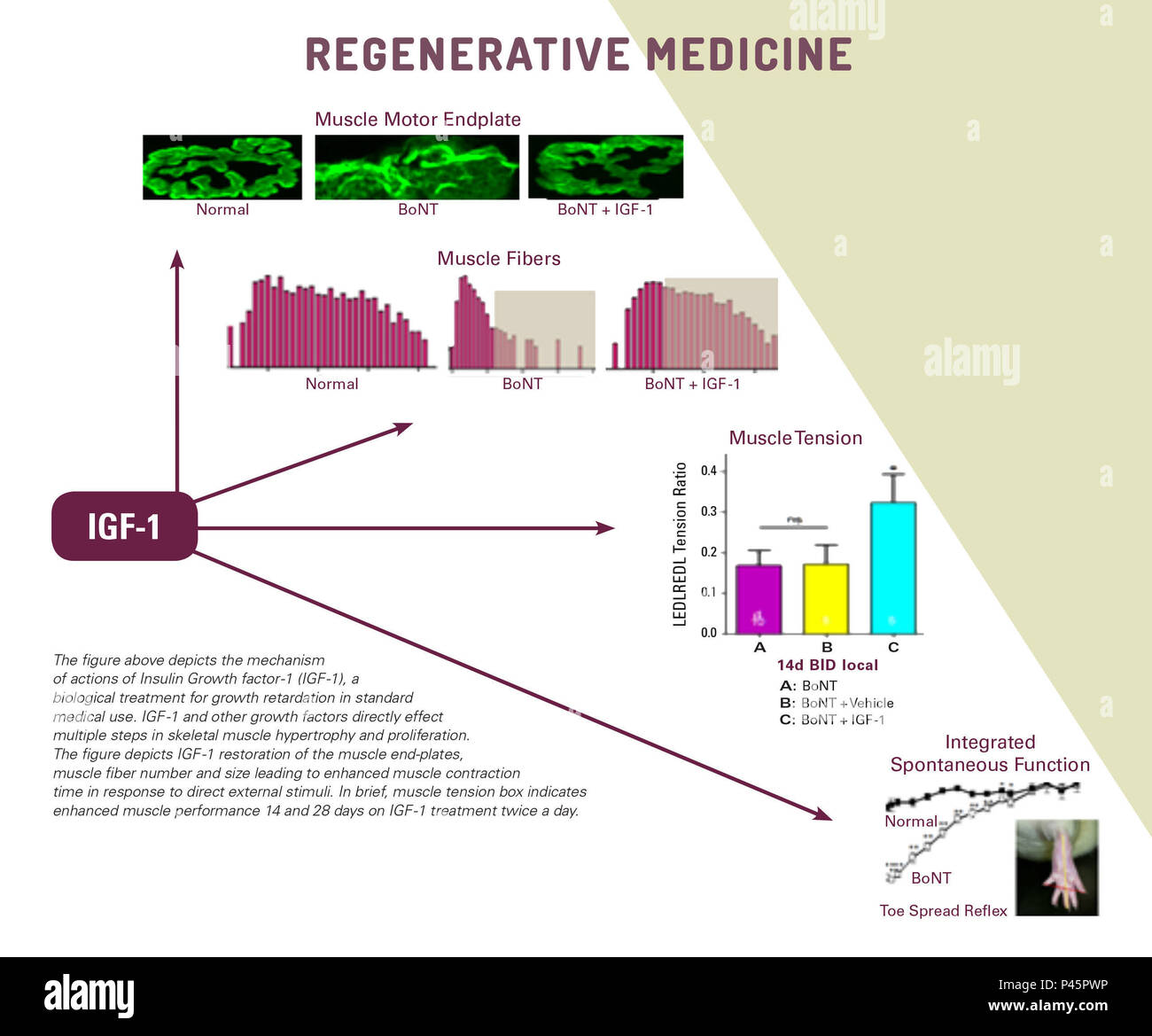 La figure ci-dessus illustre le mécanisme d'action de l'insuline facteur de croissance IGF-1 (-1), un traitement biologique pour un retard de croissance dans l'utilisation médicale standard. L'IGF-1 et d'autres facteurs de croissance directement plusieurs étapes dans l'hypertrophie musculaire squelettique et la prolifération. La figure illustre l'IGF -1 restauration de la fin de muscle-plaques, nombre et taille des fibres musculaires pour améliorer la contraction musculaire du temps en réponse aux stimuli externes directs. En bref, la tension musculaire fort indique une meilleure performance musculaire 14 et 28 jours sur l'IGF -1 traitement deux fois par jour. Photo gracieuseté de Dr. Feuerstein, JS Banque D'Images