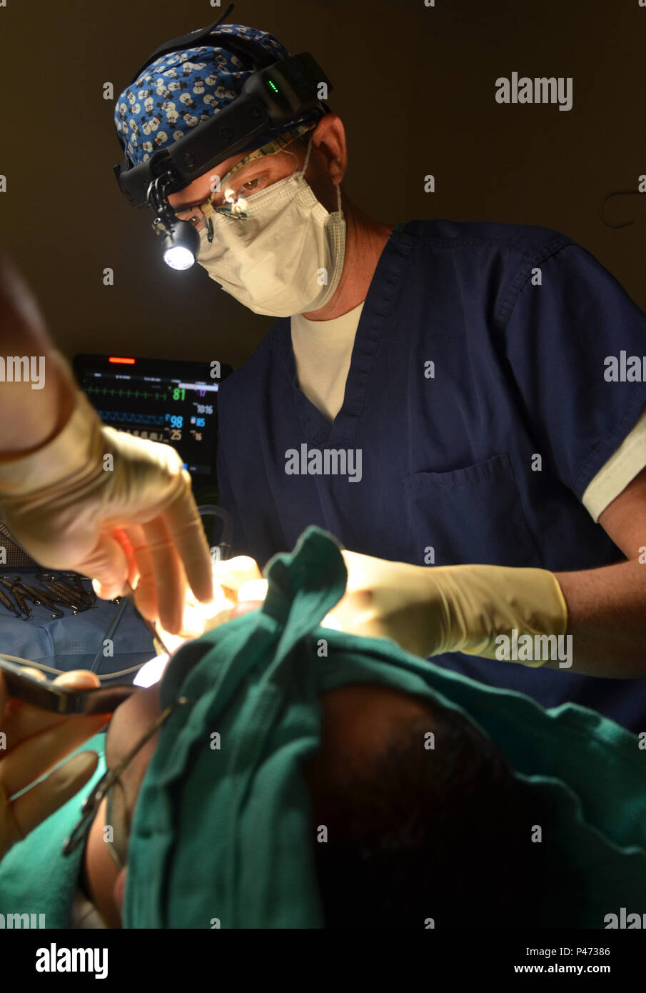 JACKSONVILLE, Floride (15 juin 2016) - Le Lieutenant Cmdr. Matthew Miller, un dentiste au Naval Hospital Jacksonville, effectue une procédure de levage du sinus maxillaire avec greffe osseuse et le placement d'un implant dentaire. Le Corps dentaire a été créé en 1912, et quelques années plus tard, a eu un impact immédiat au cours de la Première Guerre mondiale (U.S. Photo par Marine Jacob Sippel, Naval Hospital Jacksonville Affaires Publiques/relâché). Banque D'Images