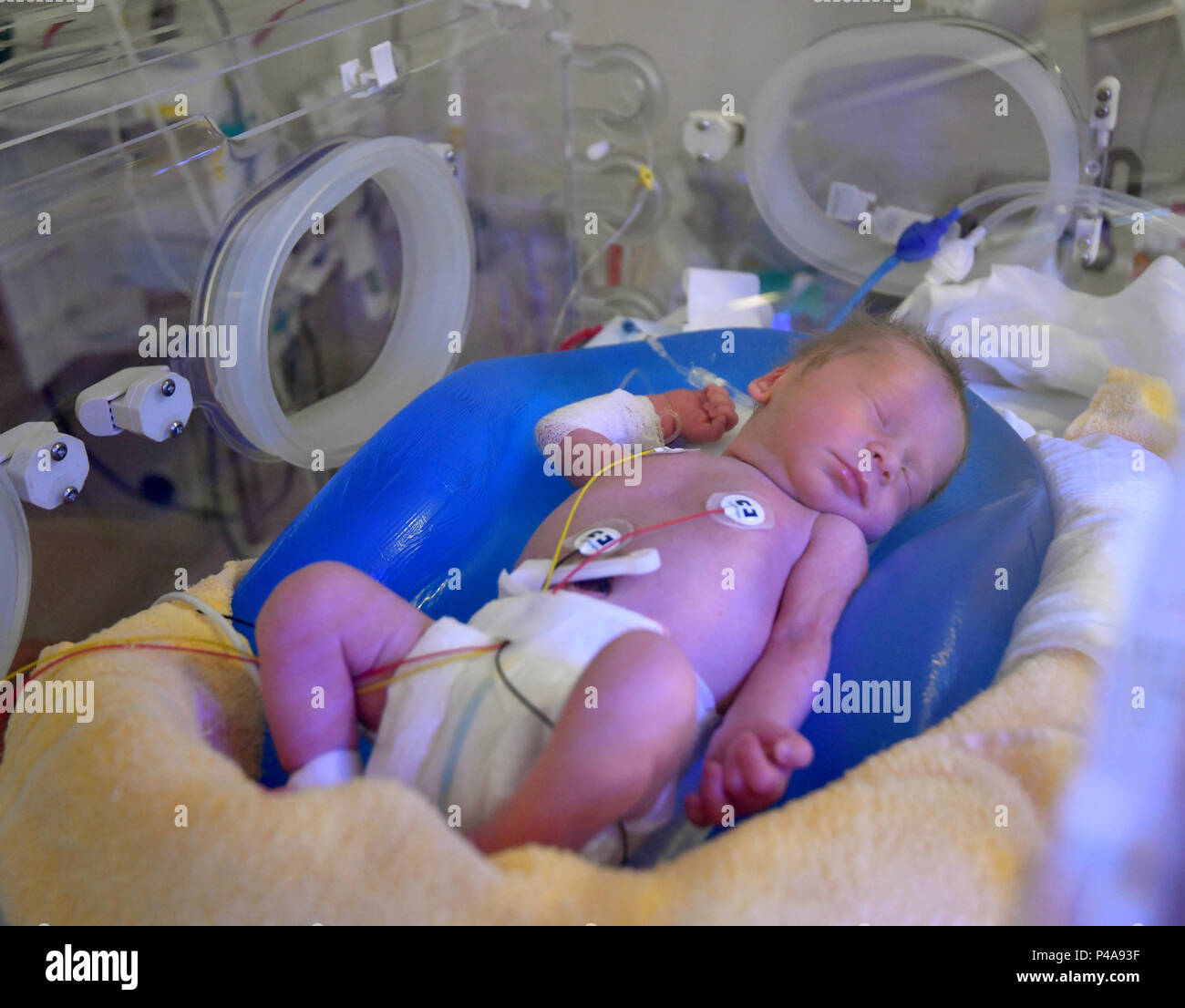 Naissance bébé fille à l'intérieur de l'incubateur à l'hôpital après la  salle d'accouchement 11673706 Photo de stock chez Vecteezy