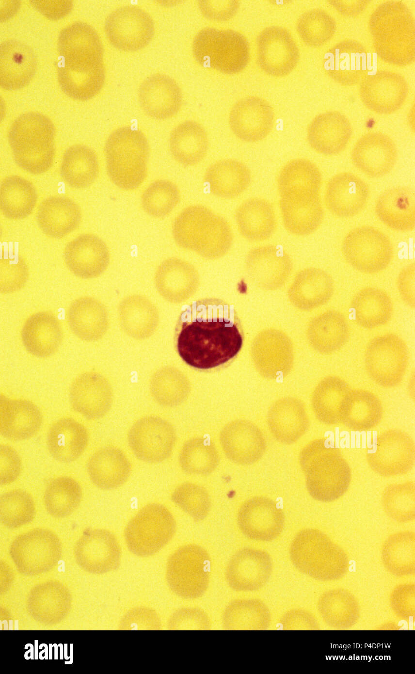 Les cellules de sang blanches . Lymphocyte. 1000x Banque D'Images