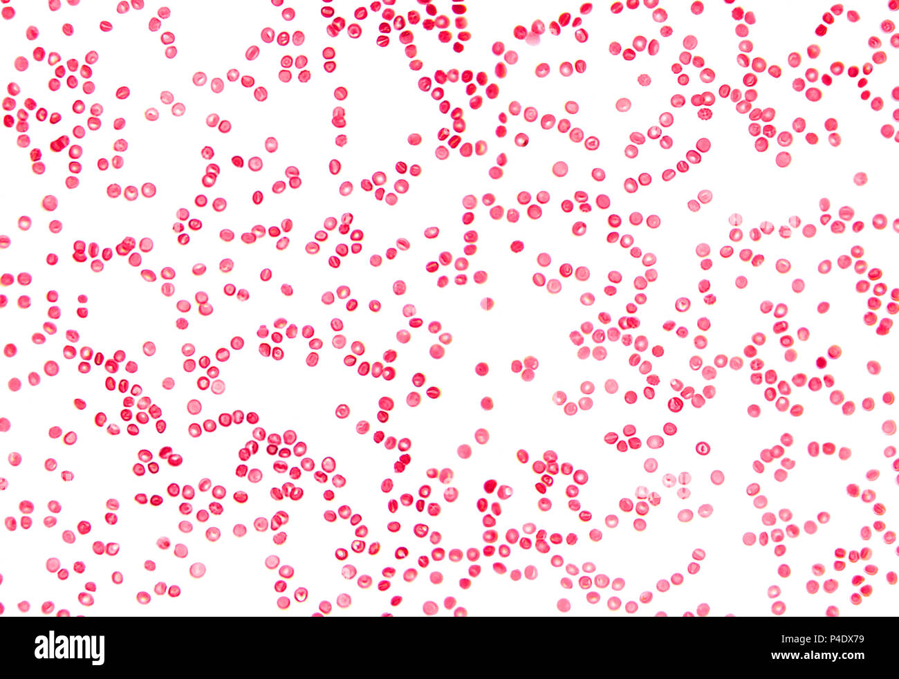 Des cellules sanguines humaines sous microscope. Des frottis grossie des globules rouges dans le plasma sanguin. Dans les liquides de l'organisme humain. L'anatomie du corps. Close up. Banque D'Images