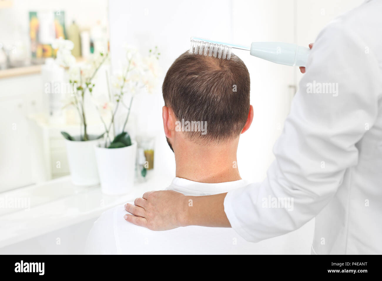 Traitement contre la perte de cheveux. Microneedle mésothérapie du cuir chevelu. La tête d'un homme avec des cheveux effilants pendant la mésothérapie d'aiguille Banque D'Images