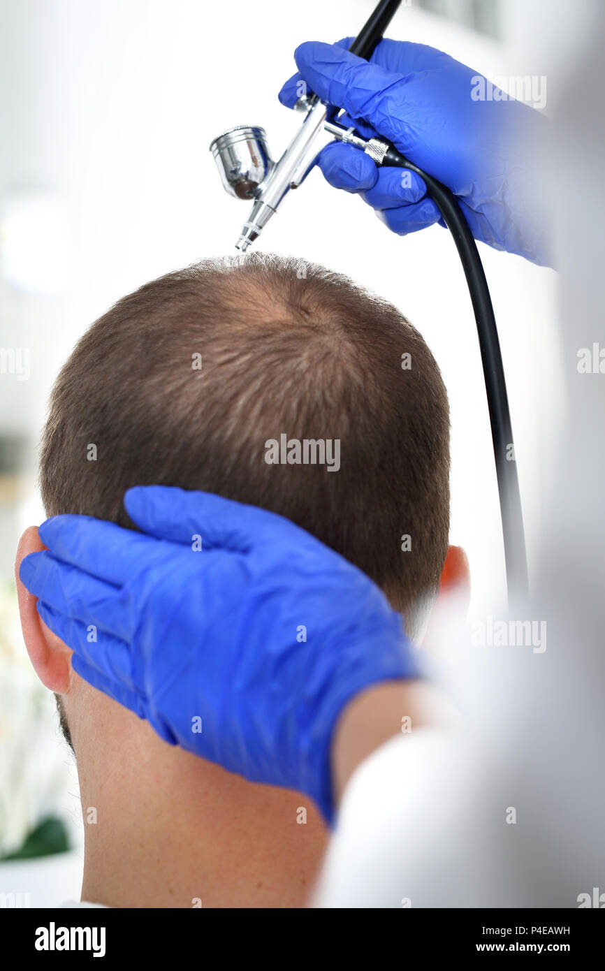 Traitement du cuir chevelu Banque de photographies et d’images à haute résolution Alamy