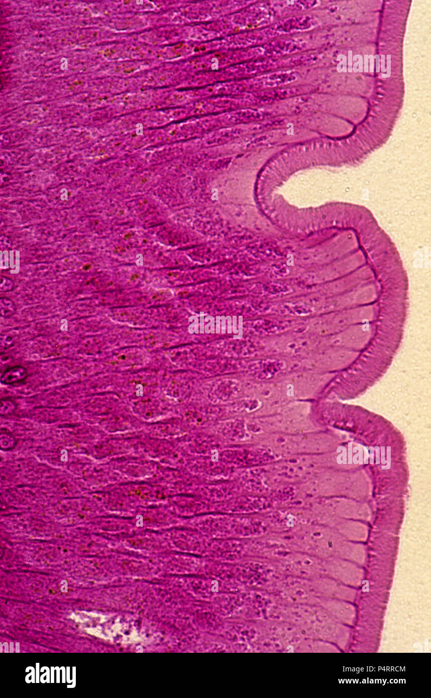Les cellules épithéliales de l'intestin d'Ascaris. 140x Banque D'Images