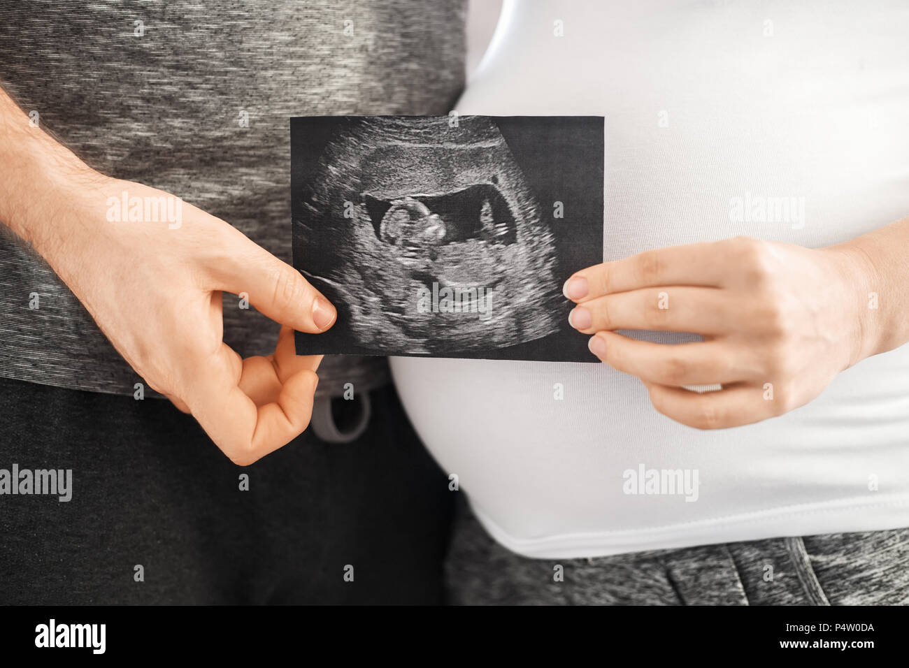 Pregnant couple holding échographie Banque D'Images