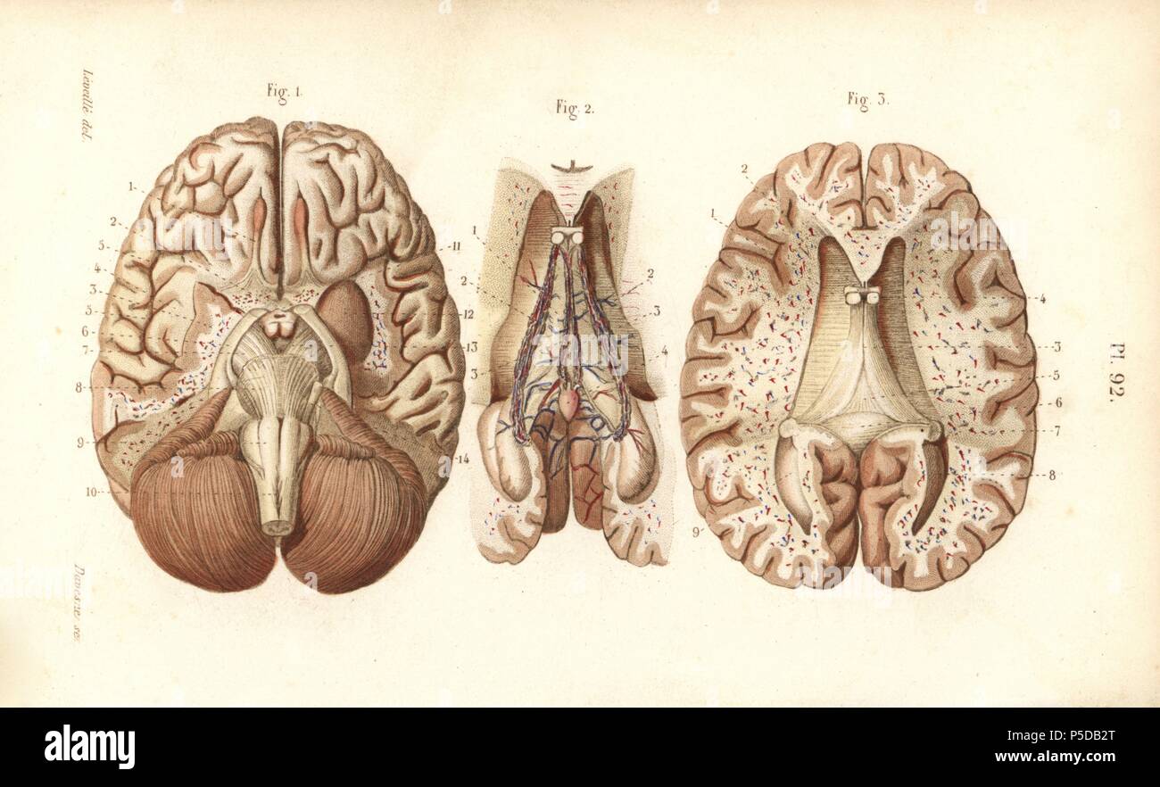 Les articles à travers le cerveau et la glande pinéale. Gravure sur acier par Davesne coloriée d'un dessin par Leveille du Dr Joseph Nicolas Masse's 'Petit Atlas complet d'Anatomie descriptive du corps humain", Paris, 1864, publié par Mequignon-Marvis. Masse 'Pocket l'anatomie du corps humain' a été publié pour la première fois en 1848 et a connu plusieurs éditions. Banque D'Images