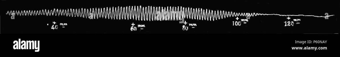 555 FI-D115-fig. 42 sphygmomanométrique - Tracé de l'état de repos Banque D'Images