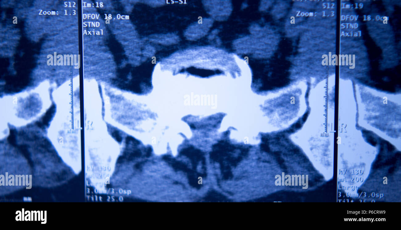 Xray hôpital médical rachis bassin hanches traumatologie IRM scan Photo Stock Alamy