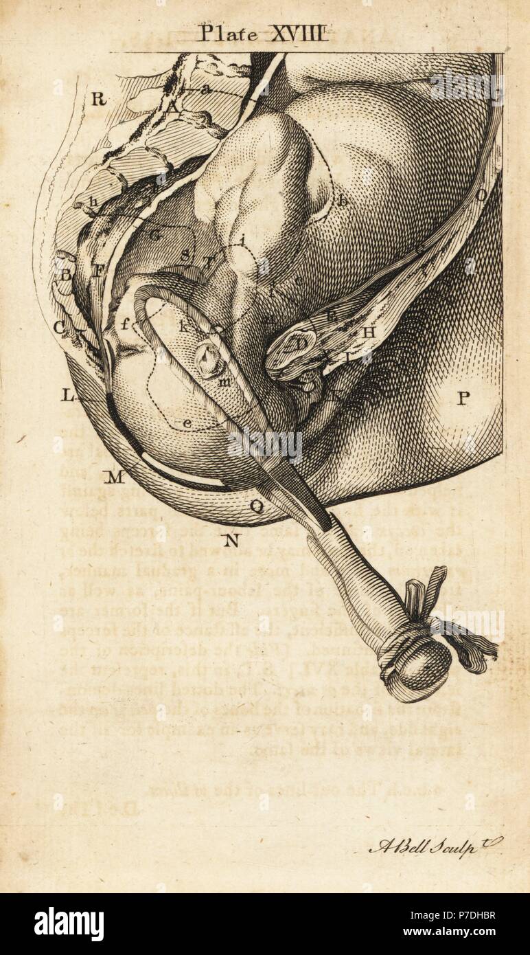 A la tête du foetus à un niveau inférieur de l'accouchement avec forceps. La gravure sur cuivre par Andrew Bell après une illustration par Jan van Rymsdyk de William Smellie est un ensemble de tables anatomiques, Charles Elliot, Édimbourg, 1780. Banque D'Images