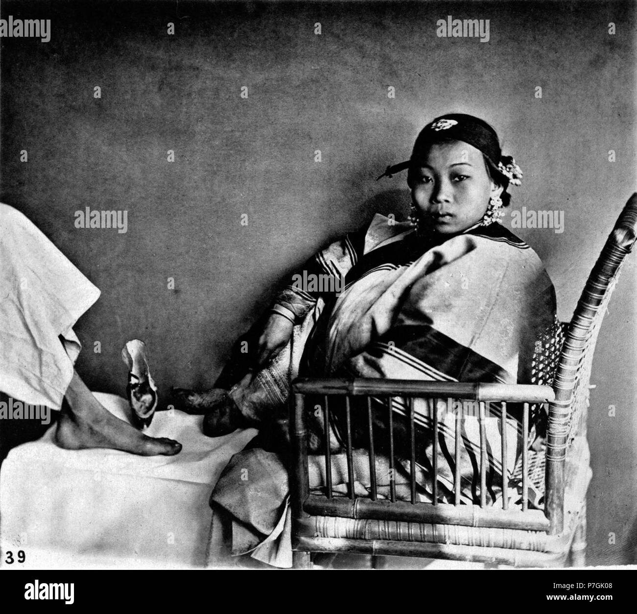 Anglais : photographie de John Thomson. Voir détail sur le lien ci-dessous. 中文（繁體）‎ 纏足與正常足的對比。 . : avant 1898 157 pied comprimé femelle, et pied naturel Banque D'Images