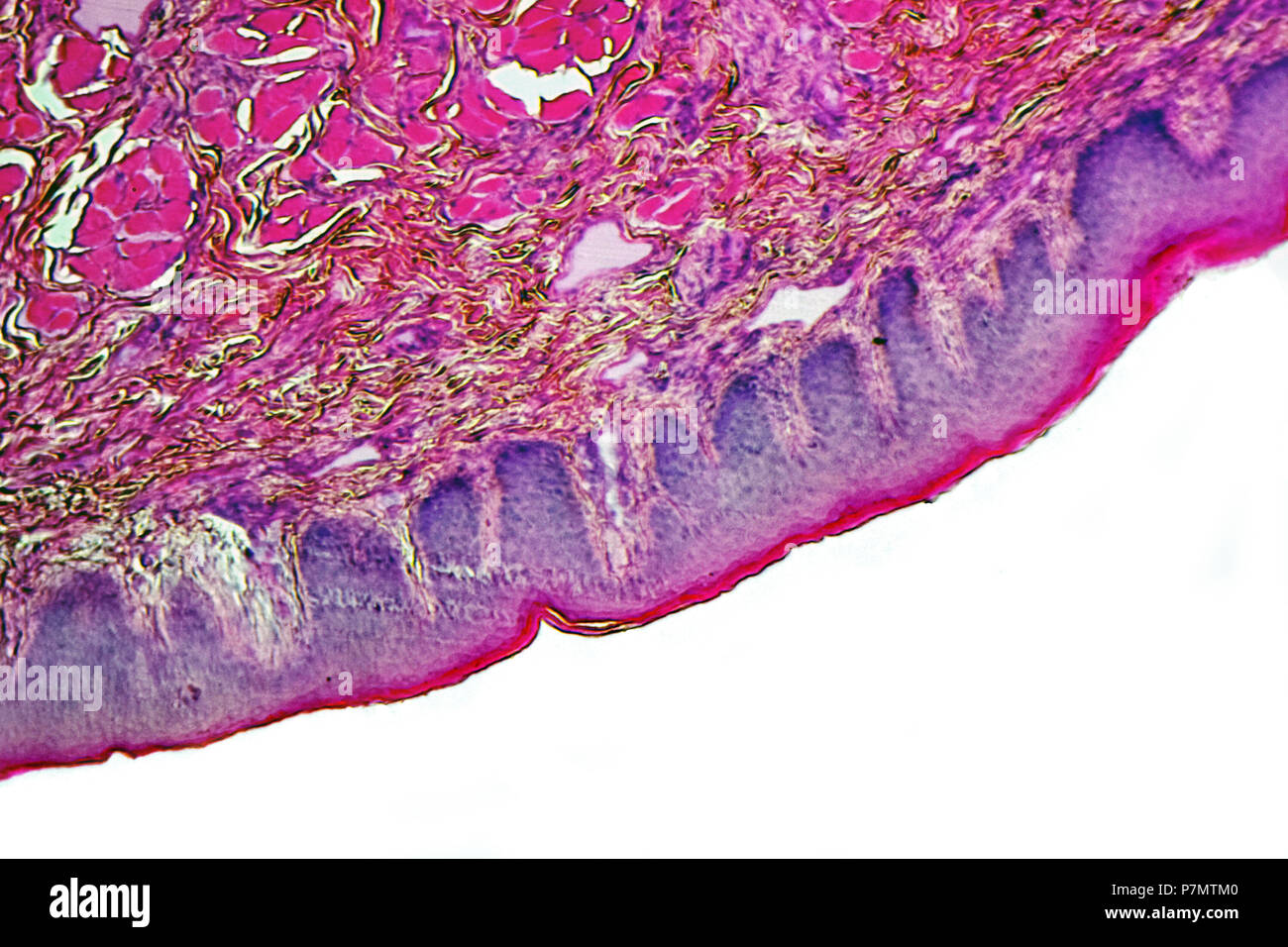 Section de Microphoto de lèvre de l'homme moderne (Homo sapiens sapiens) Banque D'Images